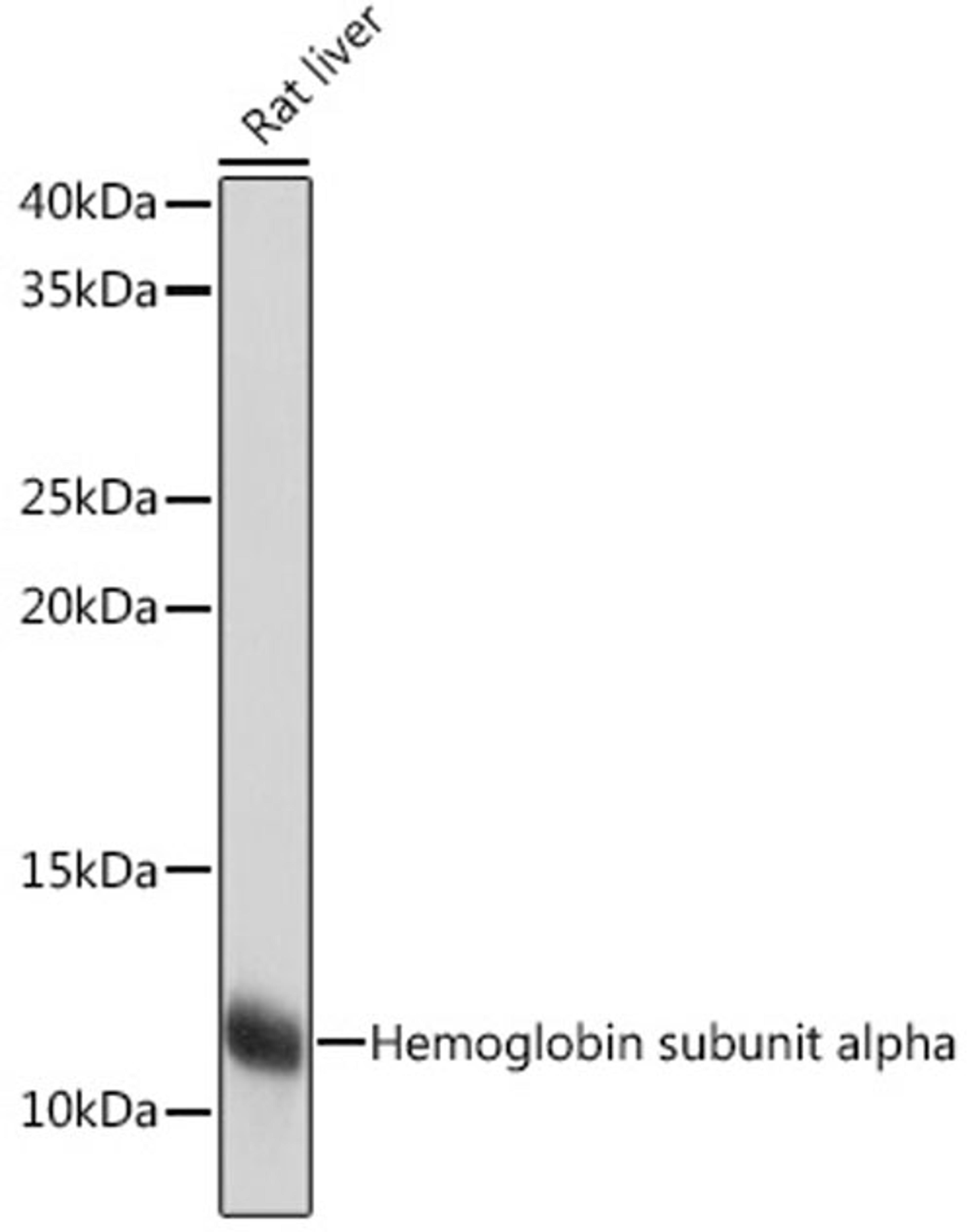 Western blot - Hemoglobin subunit alpha Rabbit mAb (A9293)