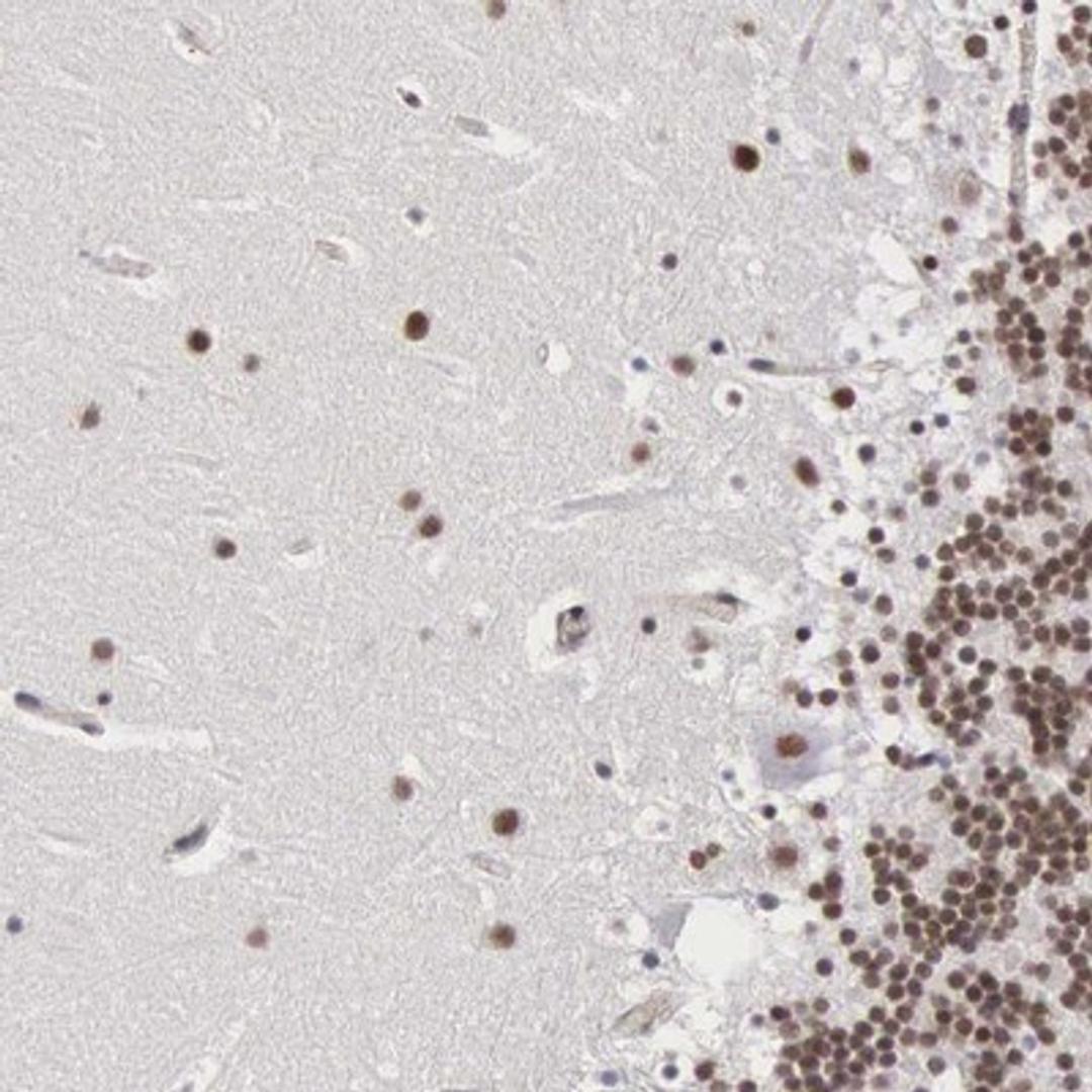 Immunohistochemistry-Paraffin: MORC2 Antibody [NBP1-89295] - Staining of human cerebellum shows distinct nuclear positivity in cerebellar tissue.