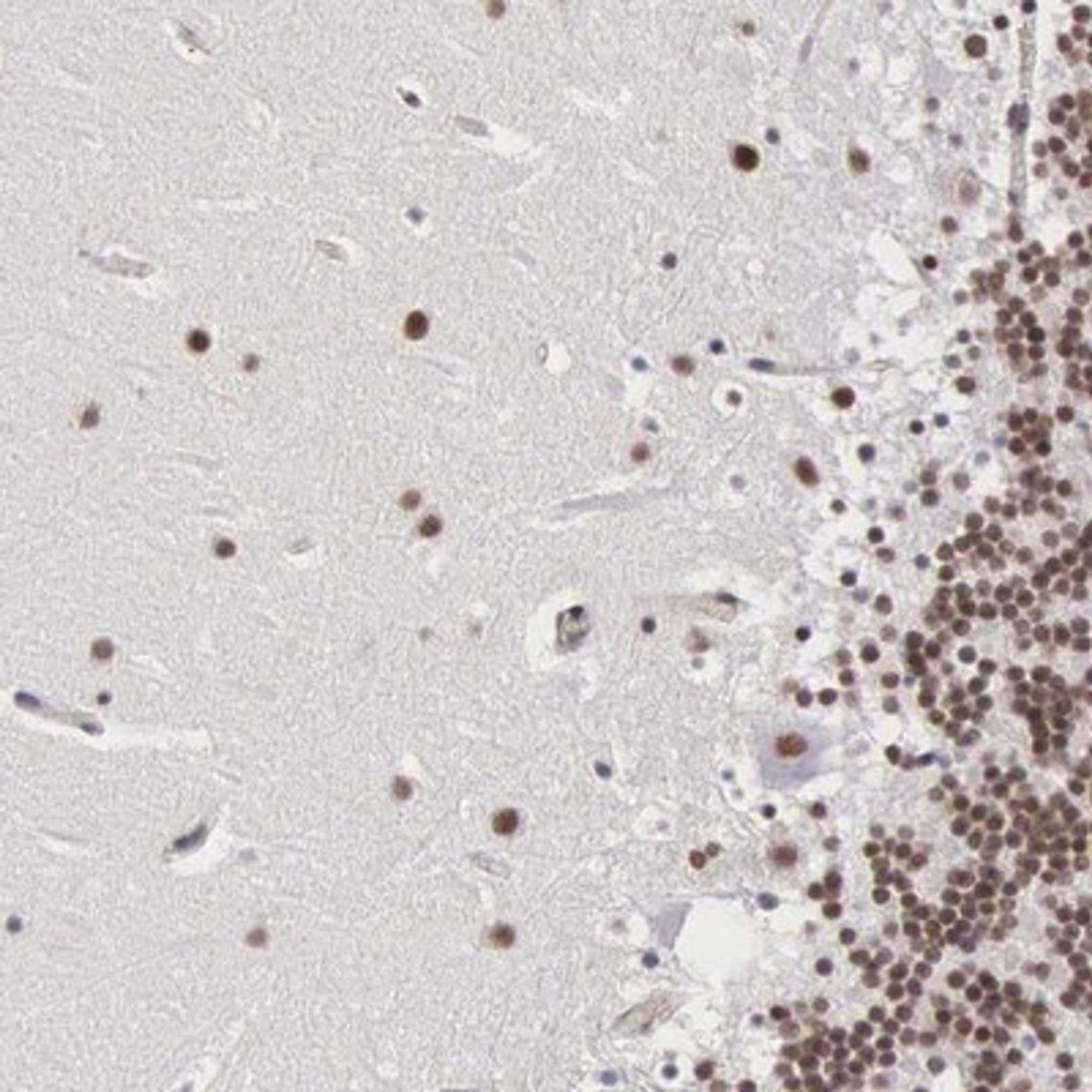 Immunohistochemistry-Paraffin: MORC2 Antibody [NBP1-89295] - Staining of human cerebellum shows distinct nuclear positivity in cerebellar tissue.