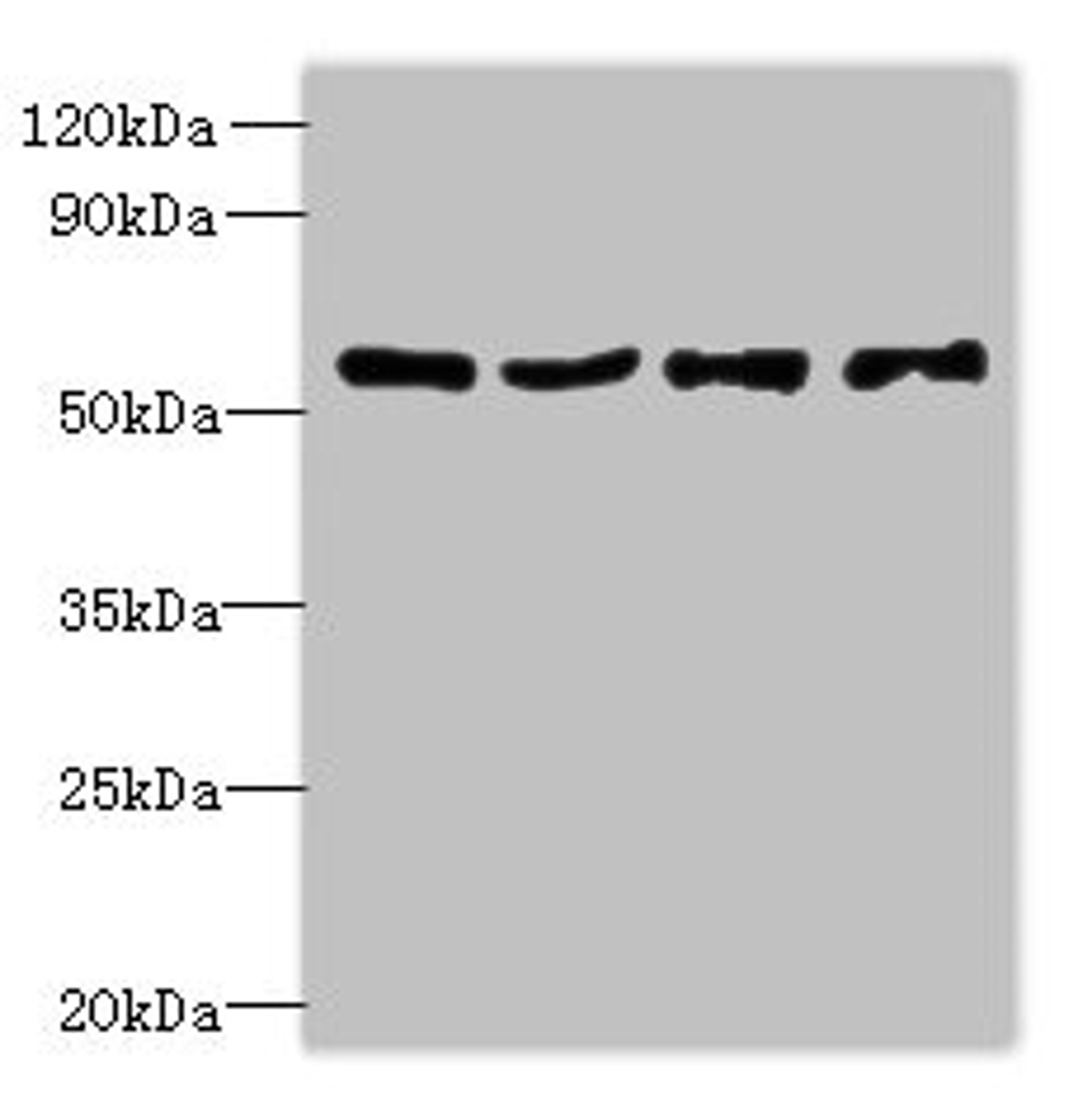 Western blot. All lanes: UBA5 antibody at 6ug/ml. Lane 1: Jurkat whole cell lysate. Lane 2: Hela whole cell lysate. Lane 3: HepG2 whole cell lysate. Lane 4: Caco-2 whole cell lysate. Secondary. Goat polyclonal to rabbit IgG at 1/10000 dilution. Predicted band size: 45, 39 kDa. Observed band size: 45 kDa. 