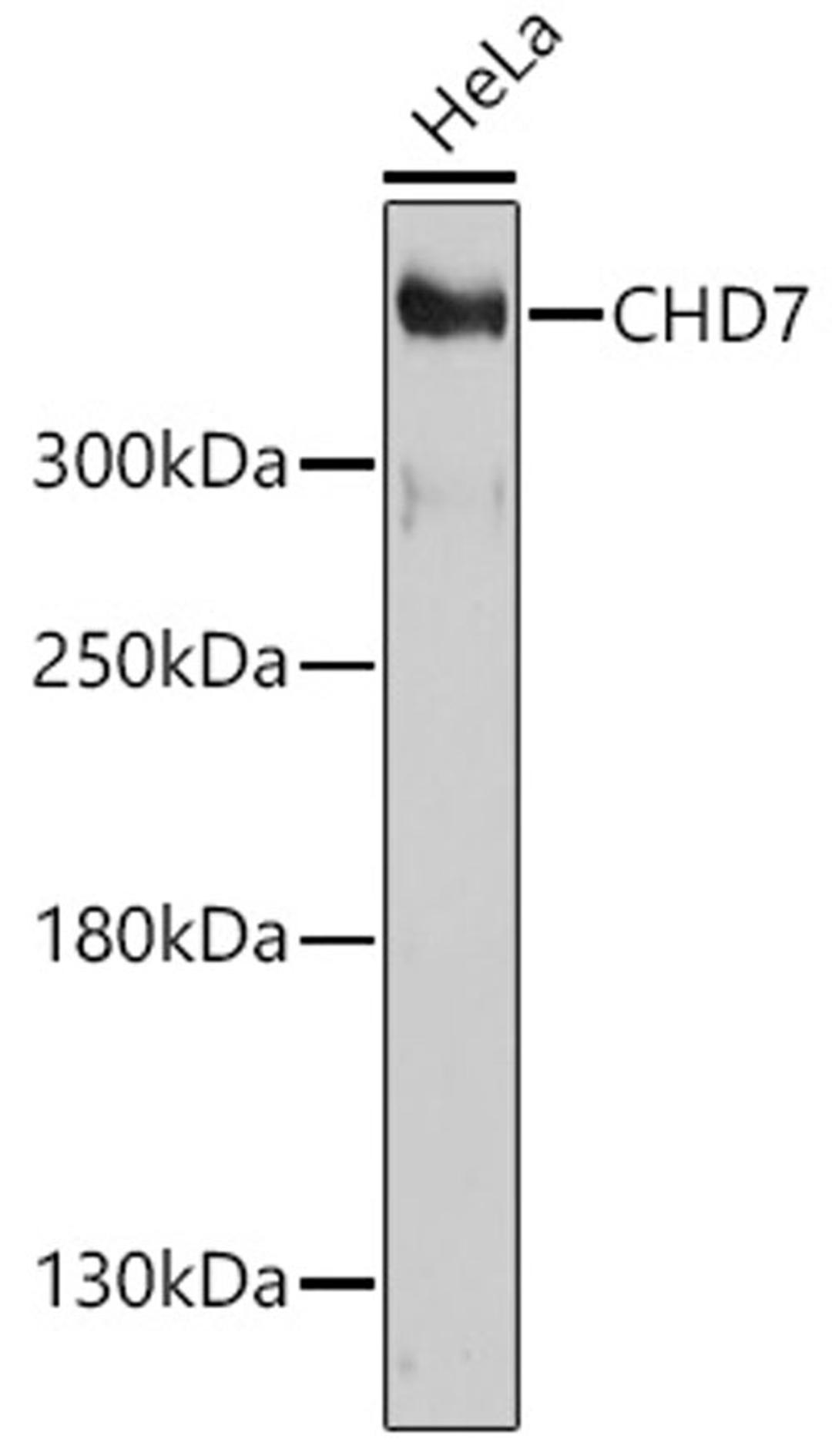 Western blot - CHD7 antibody (A17180)