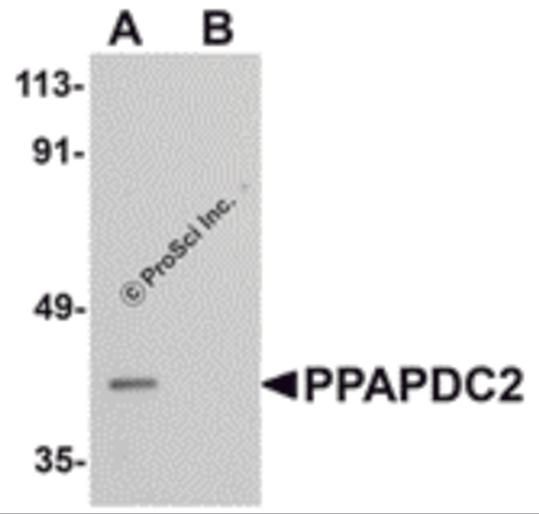 Western blot analysis of PPAPDC2 in Raji cell lysate with PPAPDC2 antibody at 1 μg/mL in (A) the absence and (B) the presence of blocking peptide.