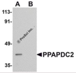 Western blot analysis of PPAPDC2 in Raji cell lysate with PPAPDC2 antibody at 1 μg/mL in (A) the absence and (B) the presence of blocking peptide.