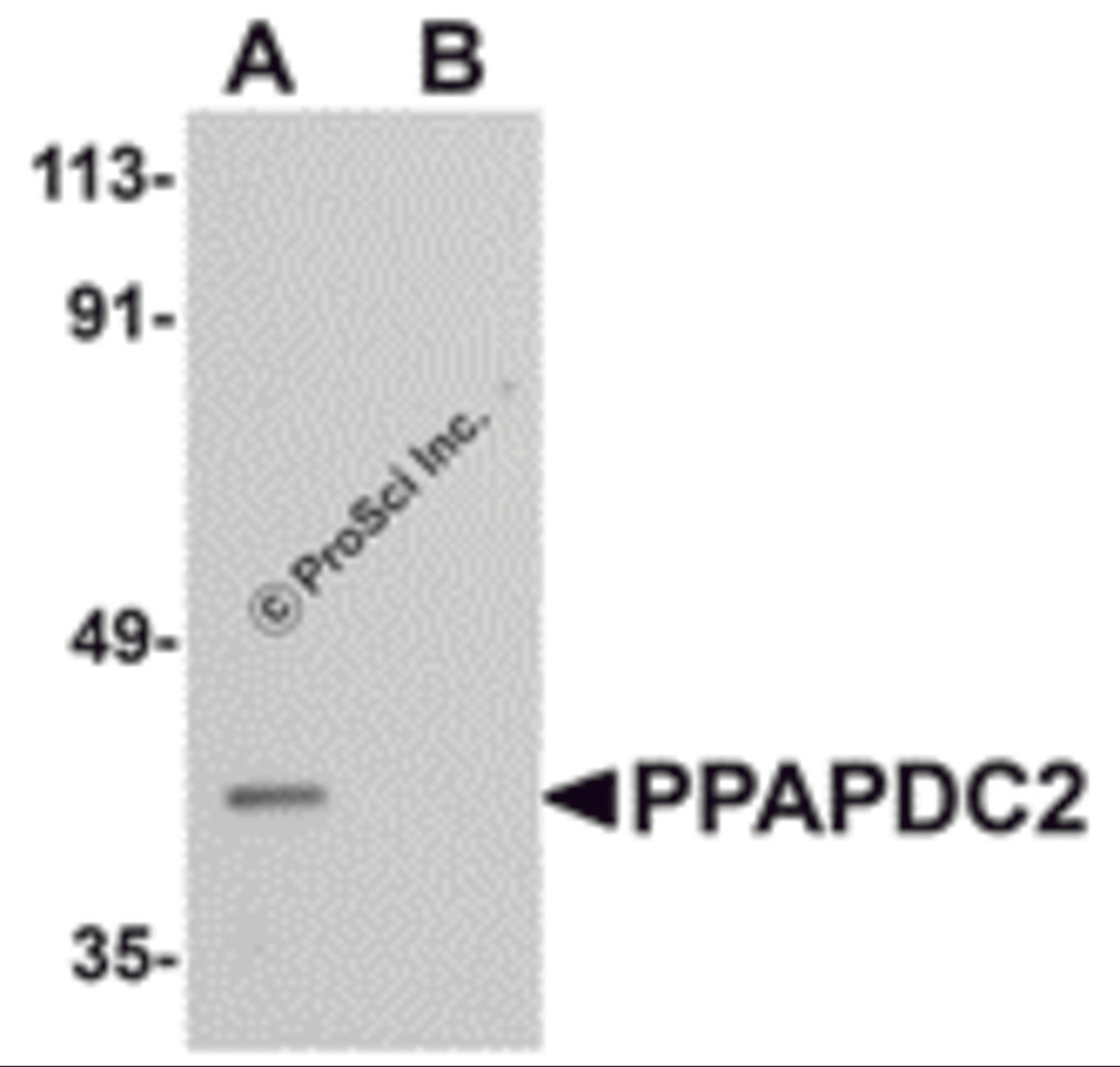Western blot analysis of PPAPDC2 in Raji cell lysate with PPAPDC2 antibody at 1 μg/mL in (A) the absence and (B) the presence of blocking peptide.