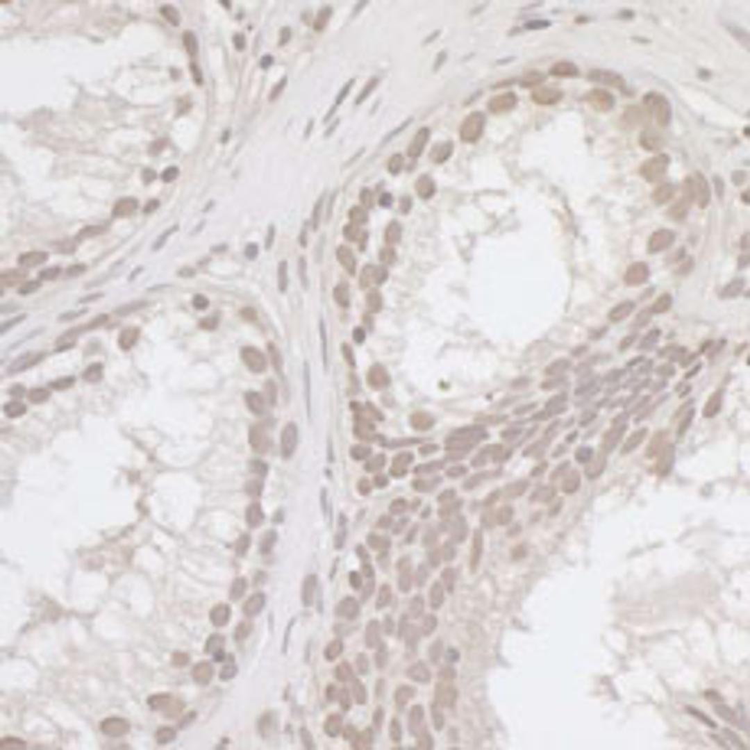 Detection of human E2F4 by immunohistochemistry.