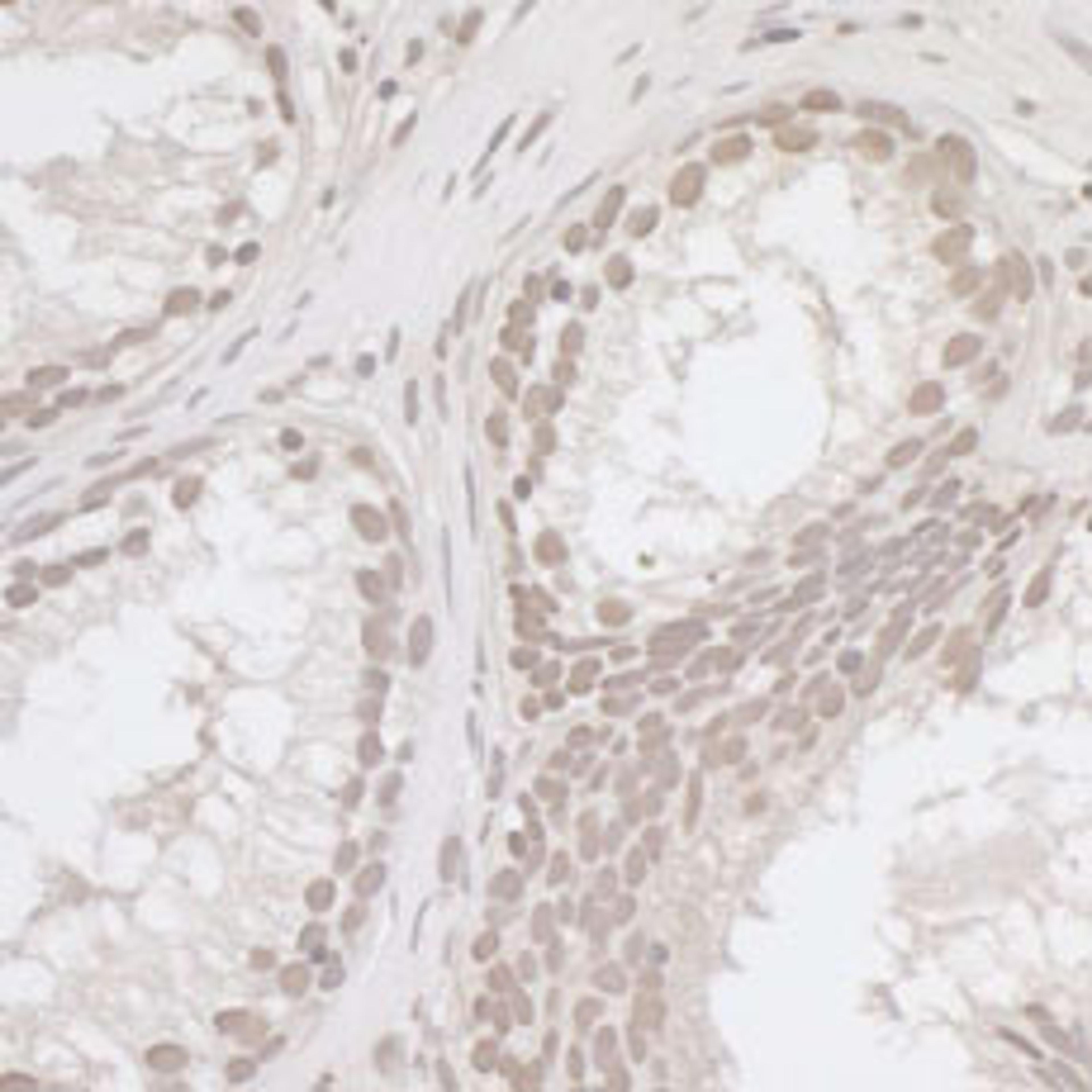 Detection of human E2F4 by immunohistochemistry.