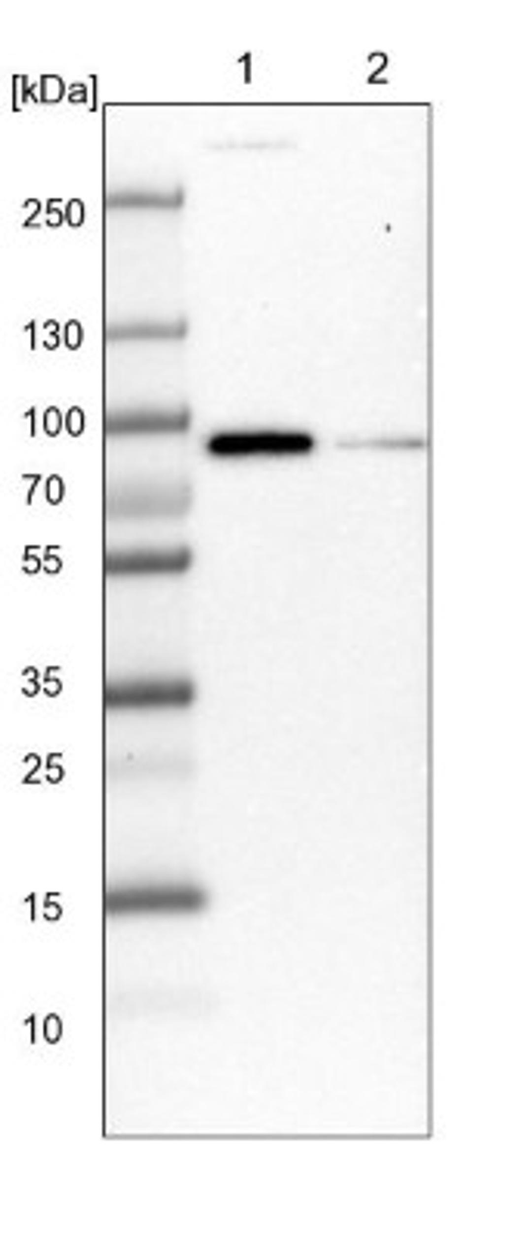 Western Blot: C9orf172 Antibody [NBP1-90935] - Lane 1: NIH-3T3 cell lysate (Mouse embryonic fibroblast cells)<br/>Lane 2: NBT-II cell lysate (Rat Wistar bladder tumour cells)