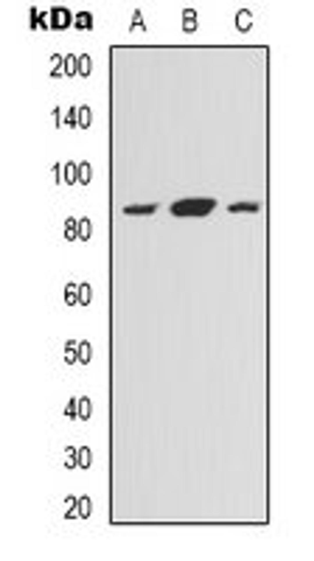 Western blot analysis of HEK293T (Lane 1), Hela (Lane 2), HepG2 (Lane 3) whole cell lysates using NOXIN antibody