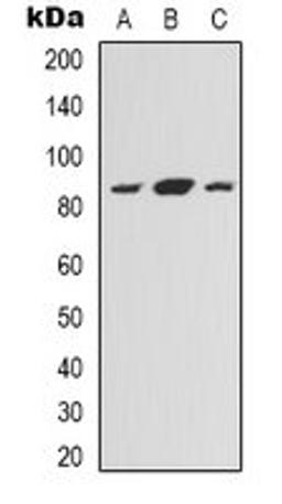 Western blot analysis of HEK293T (Lane 1), Hela (Lane 2), HepG2 (Lane 3) whole cell lysates using NOXIN antibody