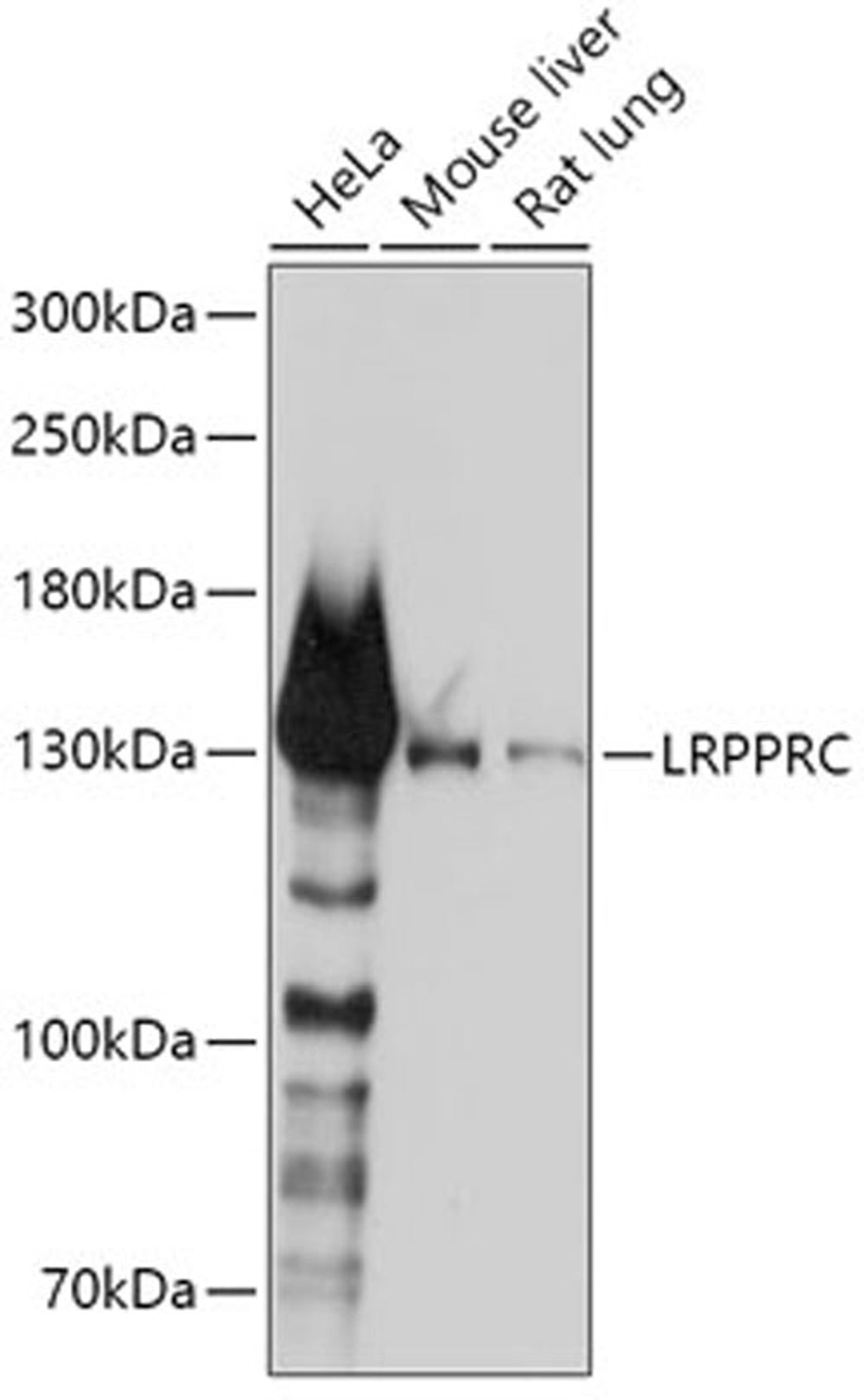 Western blot - LRPPRC antibody (A3365)