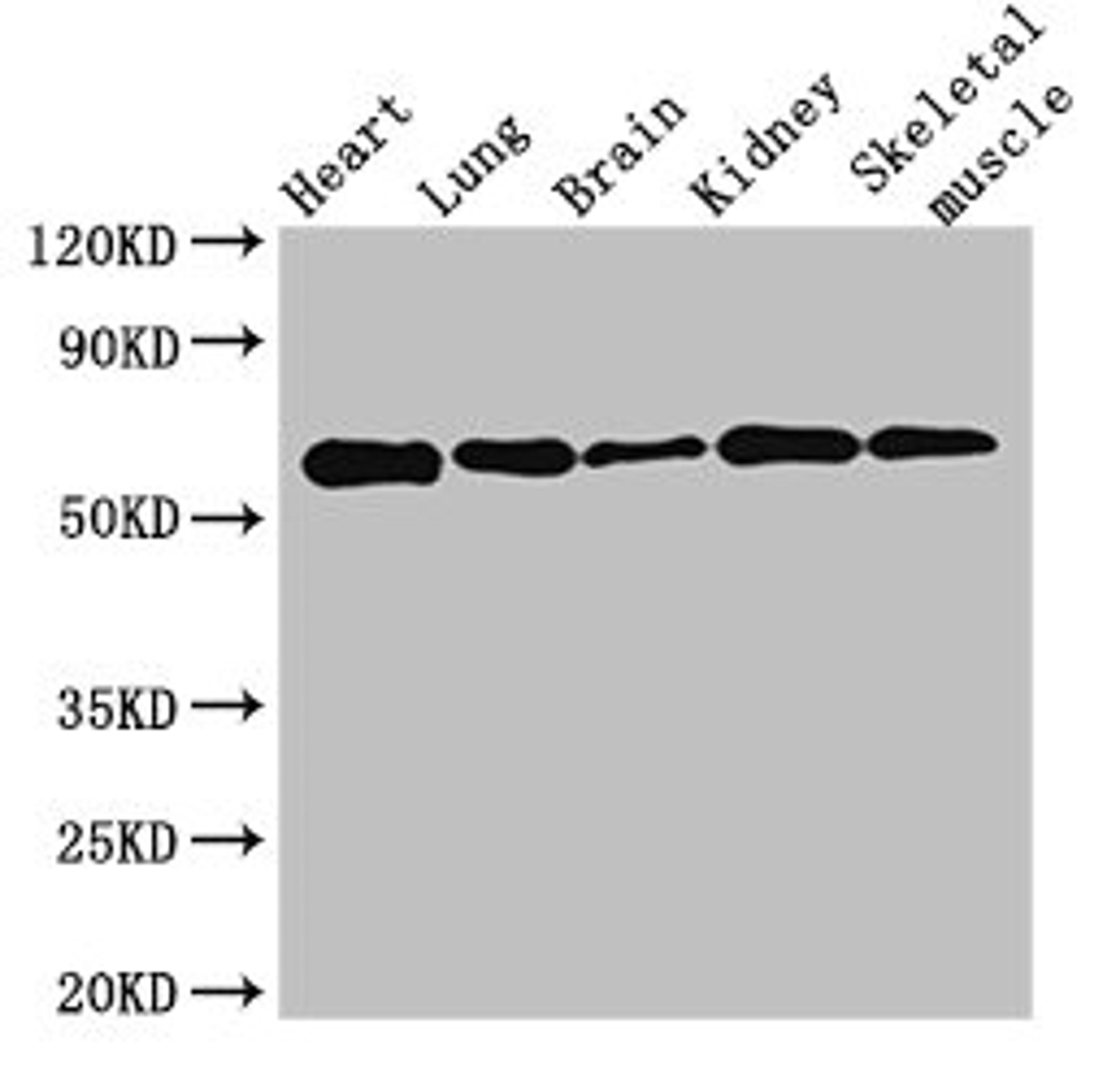 Western Blot. Positive WB detected in: Mouse heart tissue, Mouse lung tissue, Mouse brain tissue, Mouse kidney tissue, Mouse skeletal muscle tissue. All lanes: KPNA4 antibody at 3.5ug/ml. Secondary. Goat polyclonal to rabbit IgG at 1/50000 dilution. Predicted band size: 58 kDa. Observed band size: 58 kDa.