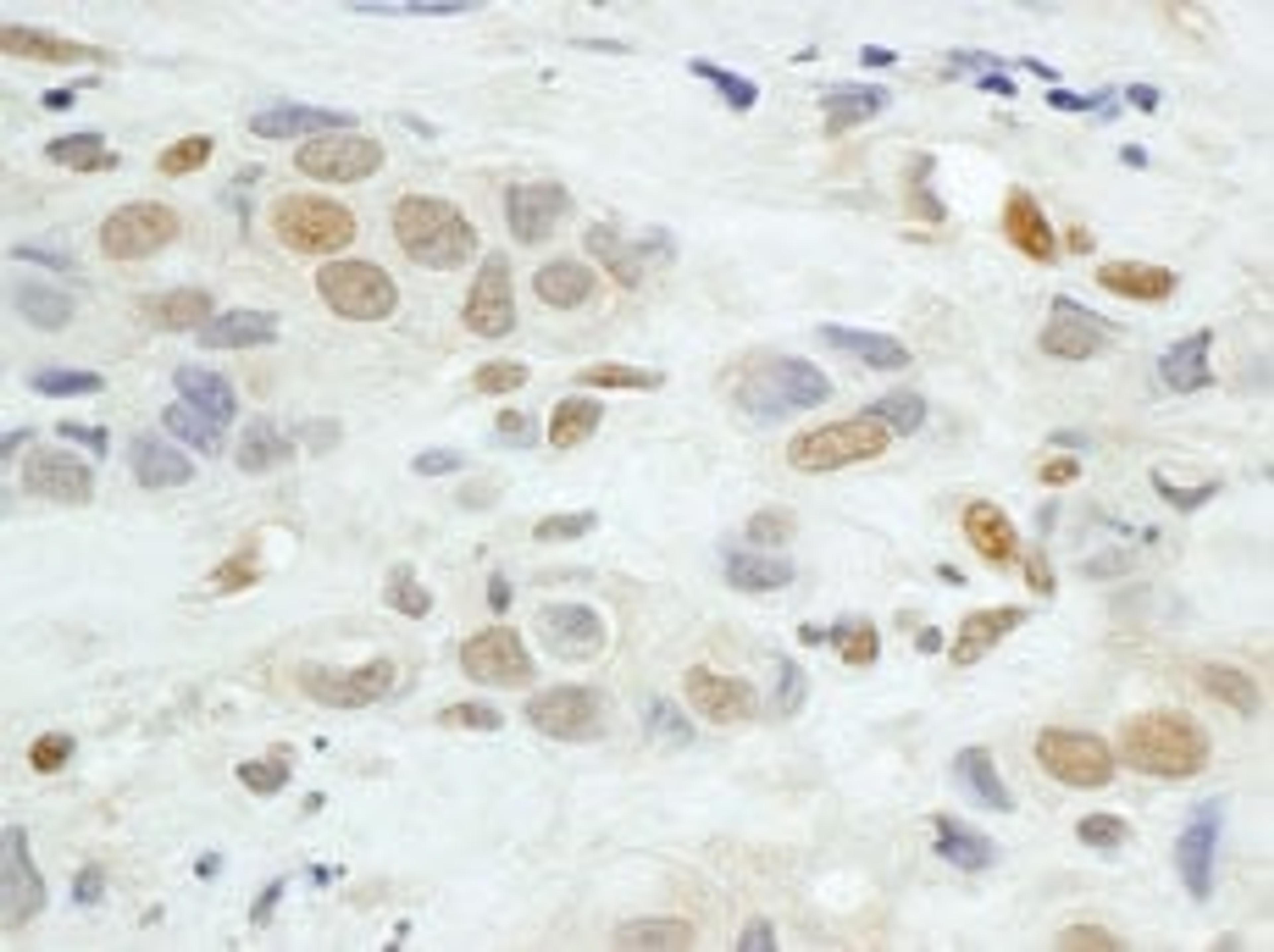 Detection of human JunB by immunohistochemistry.