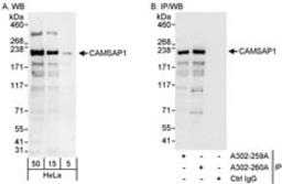 Detection of human CAMSAP1 by western blot and immunoprecipitation.