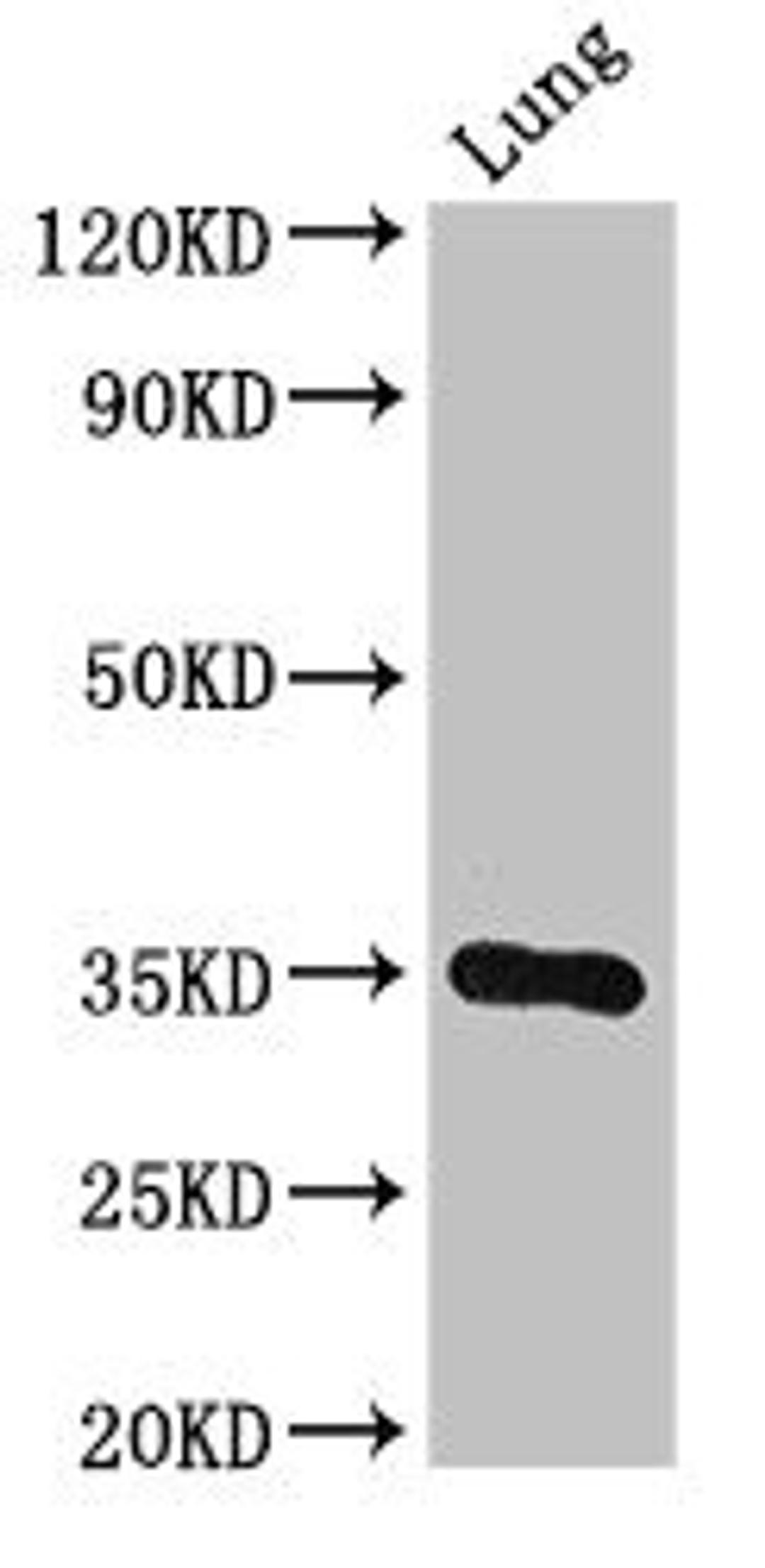 Western Blot. Positive WB detected in: Mouse lung tissue. All lanes: DPM1 antibody at 3ug/ml. Secondary. Goat polyclonal to rabbit IgG at 1/50000 dilution. Predicted band size: 30 kDa. Observed band size: 30 kDa. 
