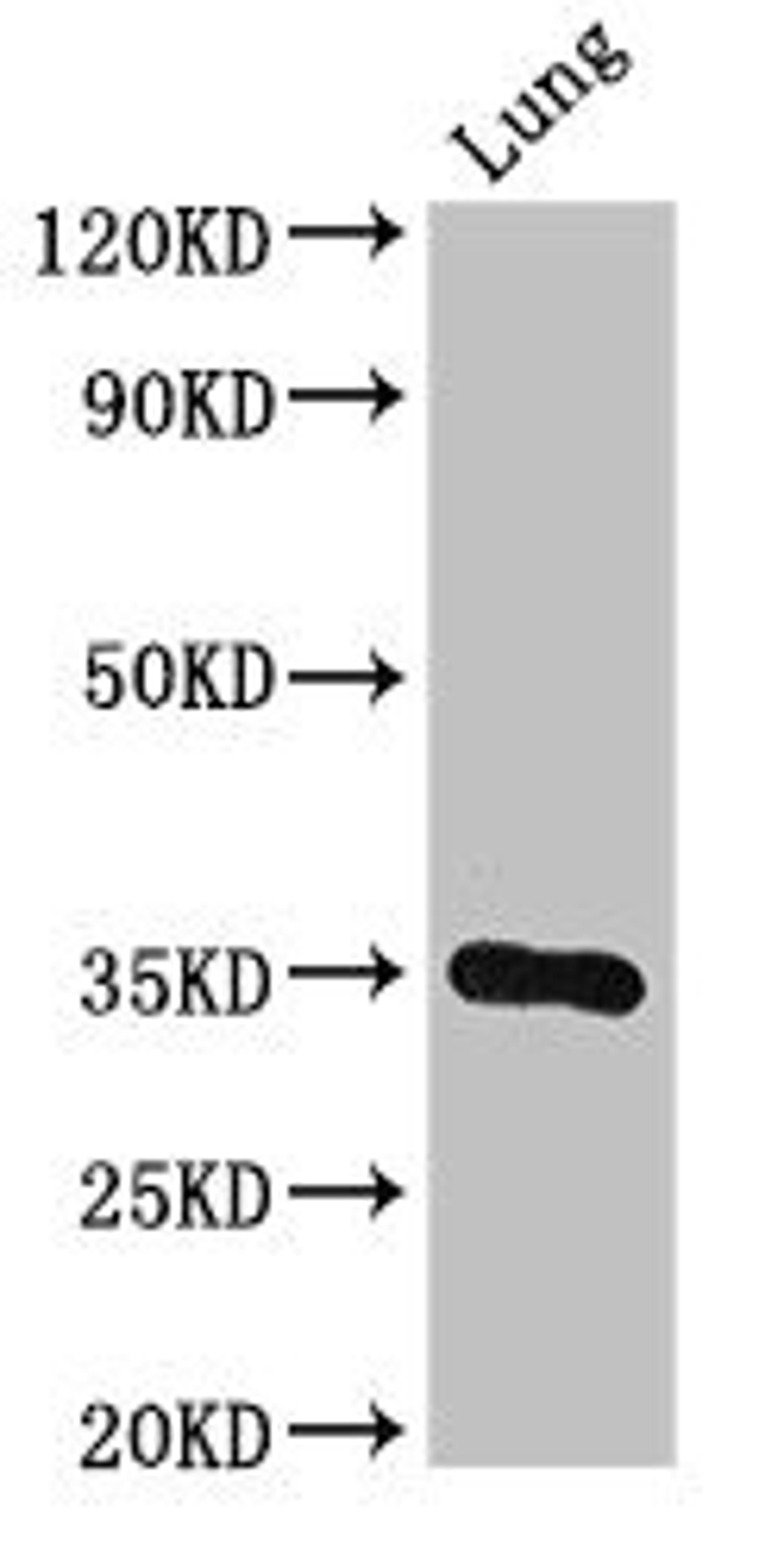Western Blot. Positive WB detected in: Mouse lung tissue. All lanes: DPM1 antibody at 3ug/ml. Secondary. Goat polyclonal to rabbit IgG at 1/50000 dilution. Predicted band size: 30 kDa. Observed band size: 30 kDa. 