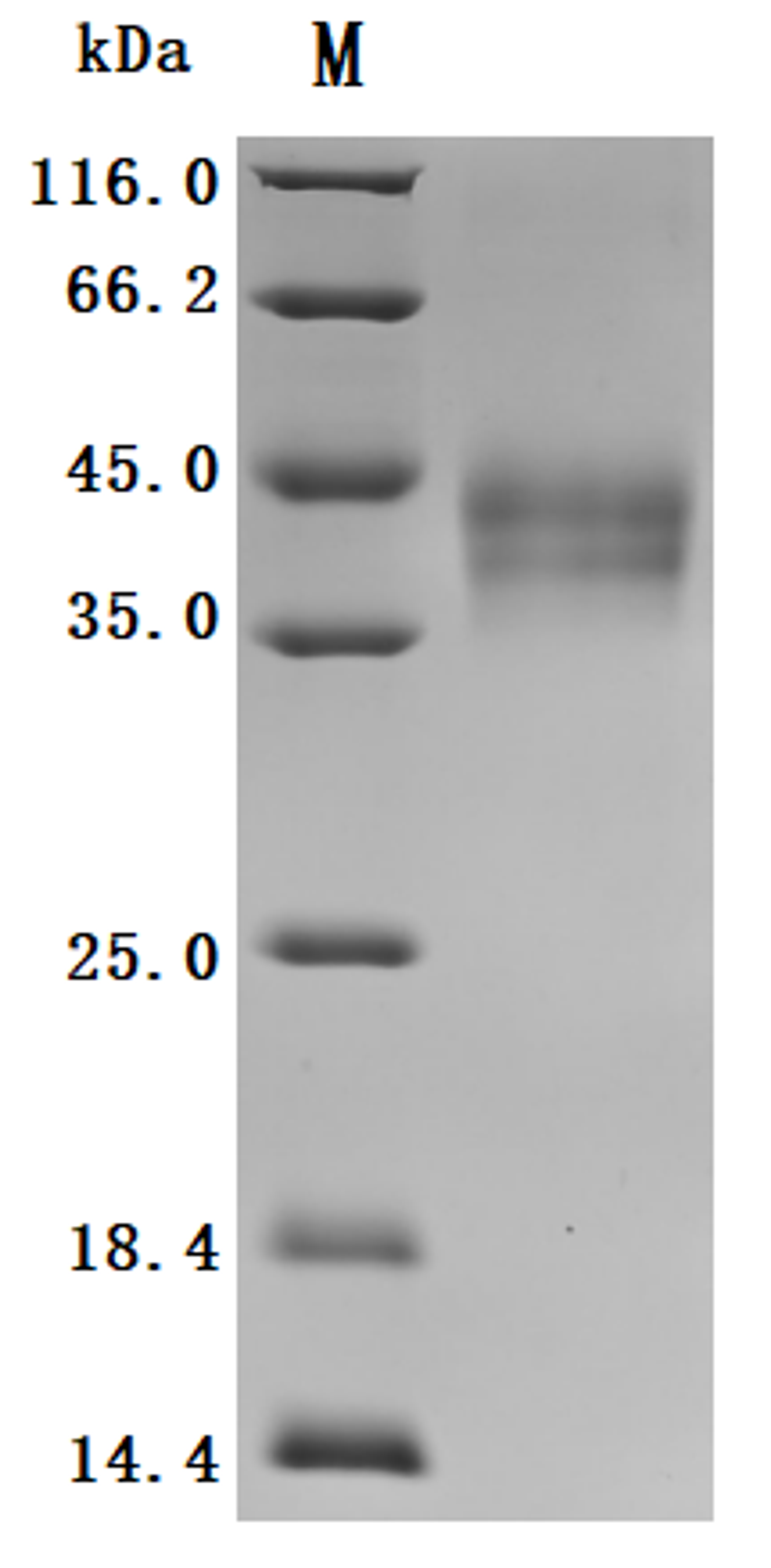 (Tris-Glycine gel) Discontinuous SDS-PAGE (reduced) with 5% enrichment gel and 15% separation gel.
