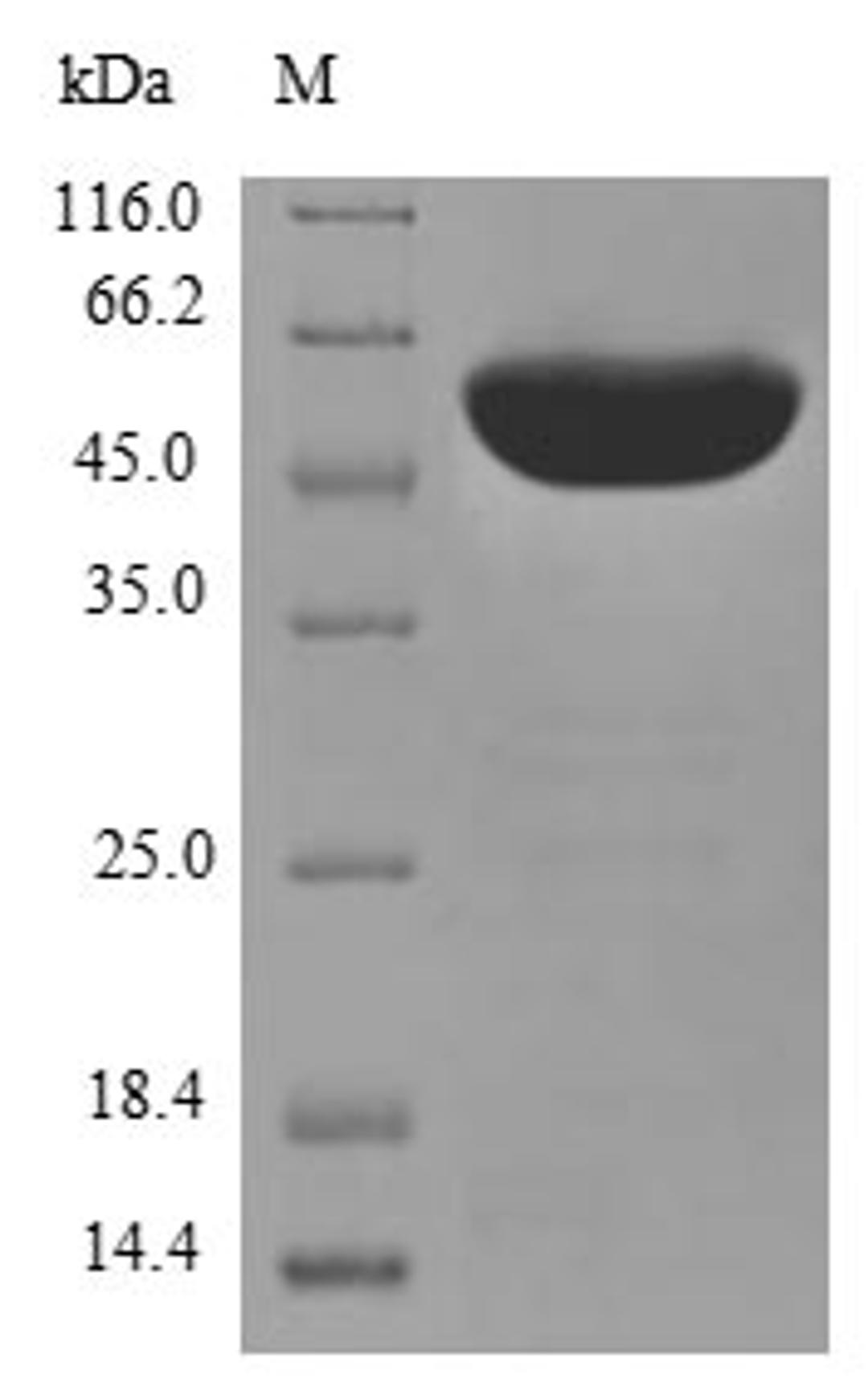 (Tris-Glycine gel) Discontinuous SDS-PAGE (reduced) with 5% enrichment gel and 15% separation gel.