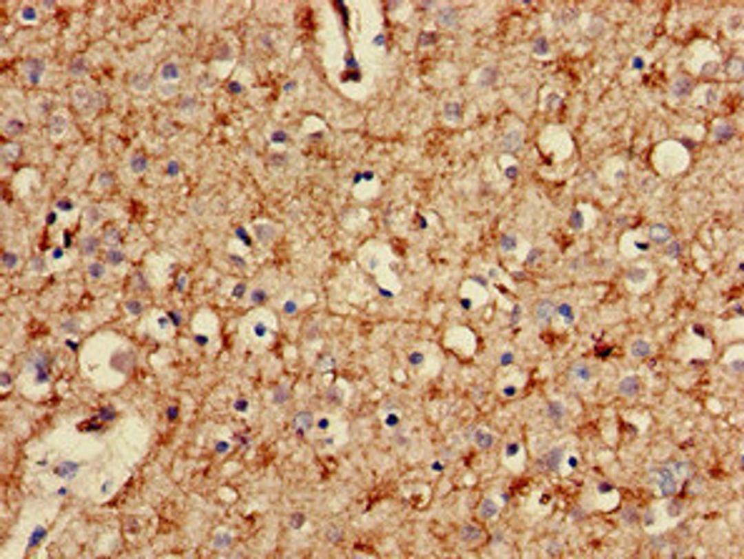 Immunohistochemistry of paraffin-embedded human brain tissue using CSB-PA018866LA01HU at dilution of 1:100