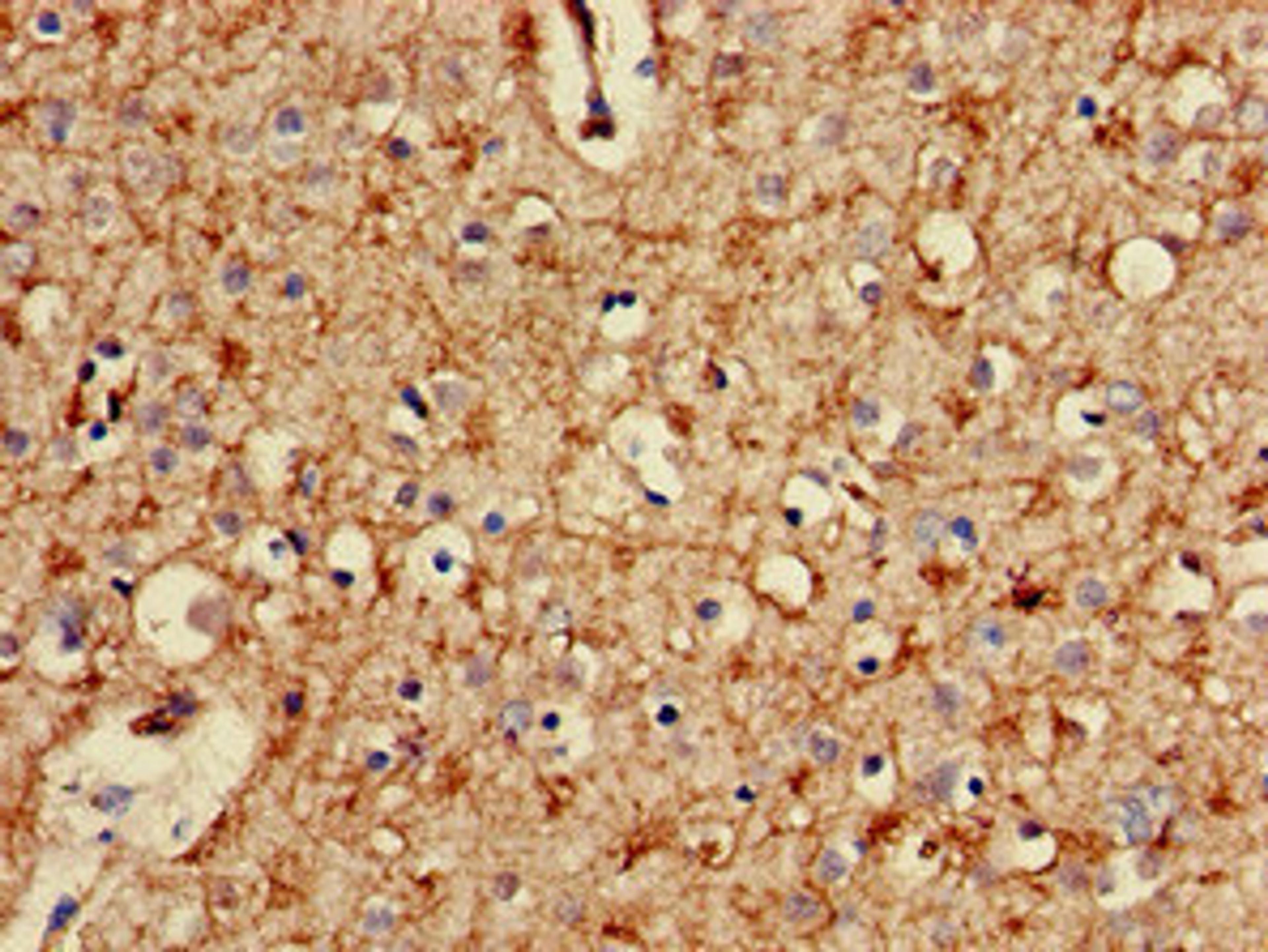 Immunohistochemistry of paraffin-embedded human brain tissue using CSB-PA018866LA01HU at dilution of 1:100