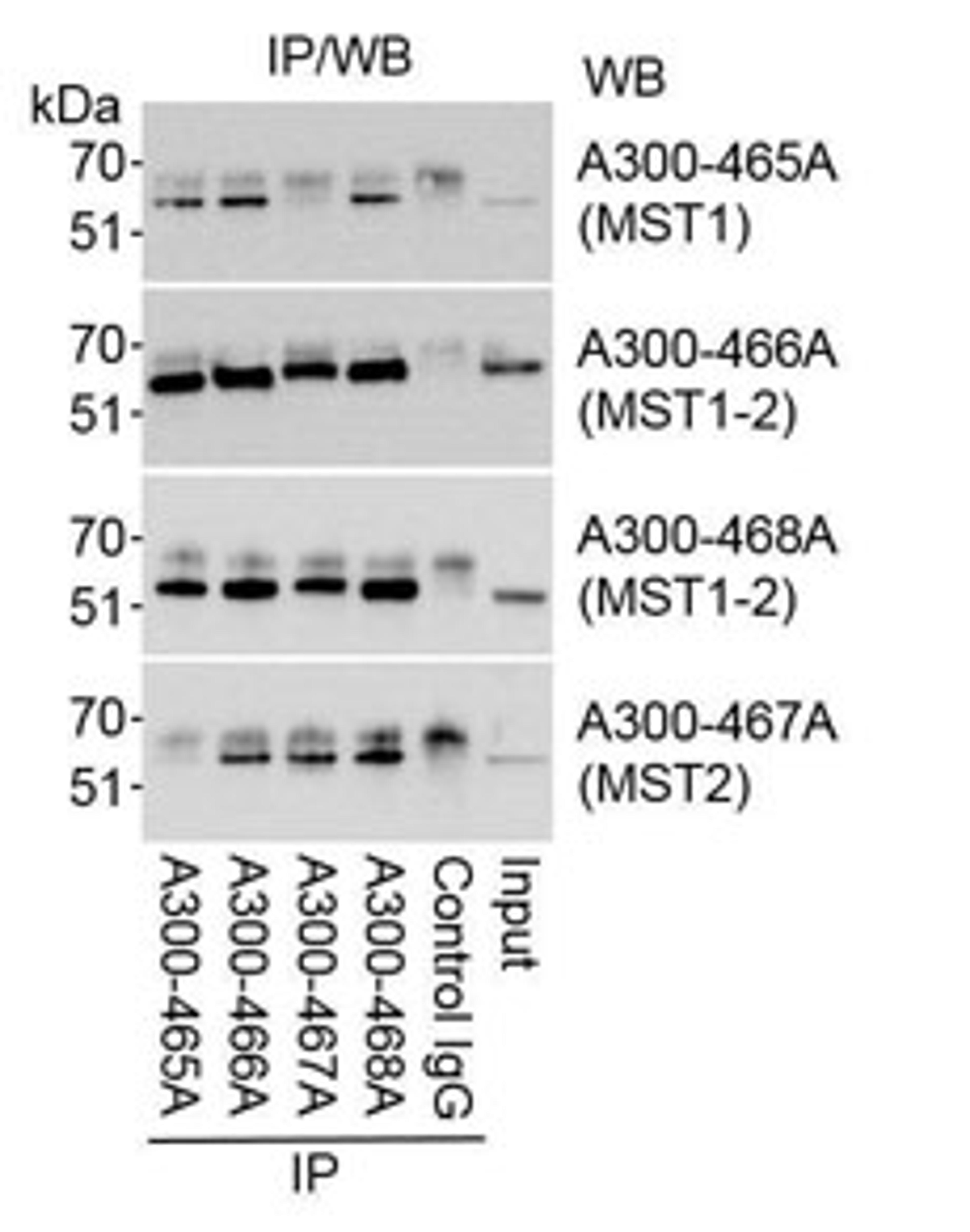 Detection of MST1 and MST2 by western blot of immunoprecipitates.