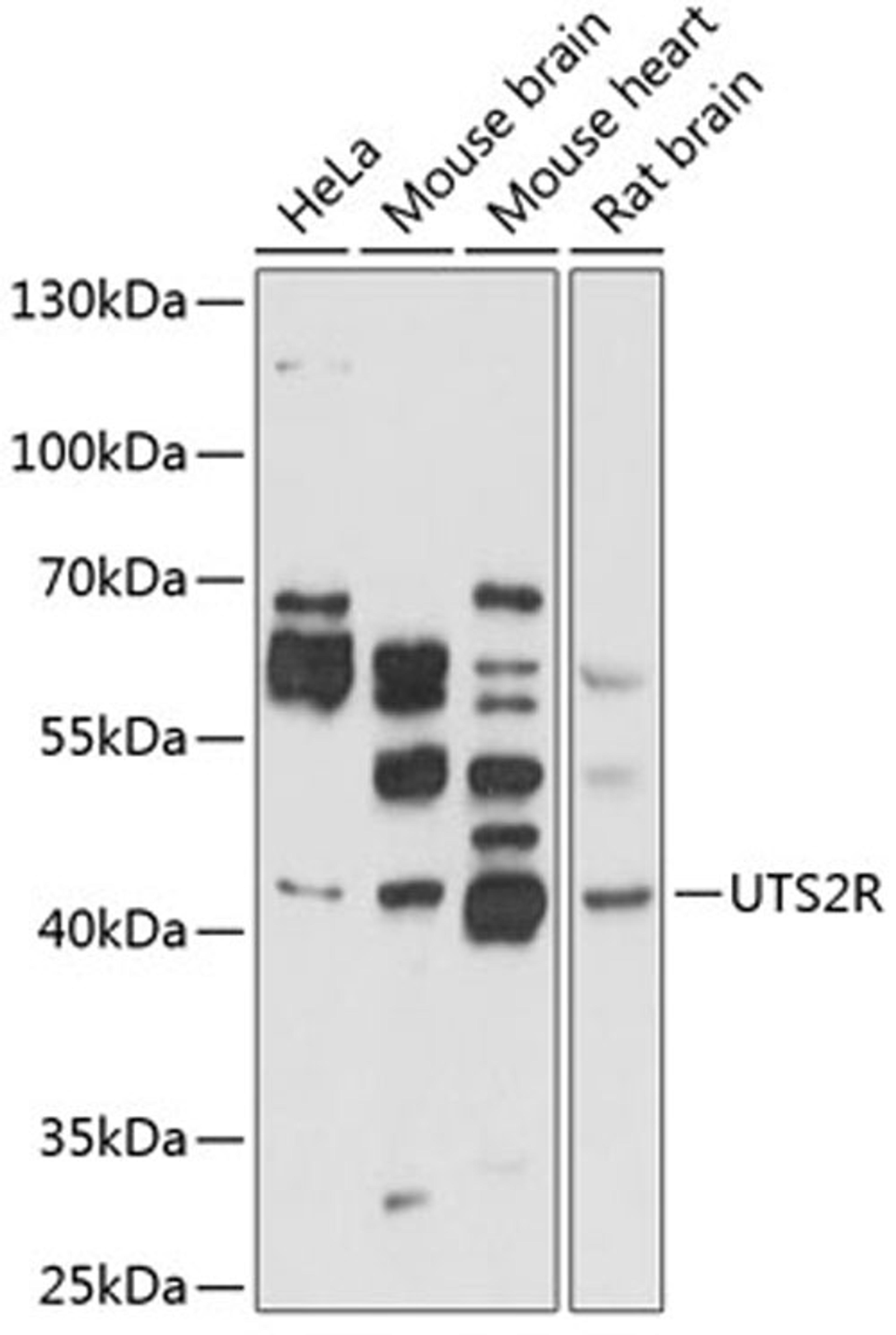 Western blot - UTS2R antibody (A2959)