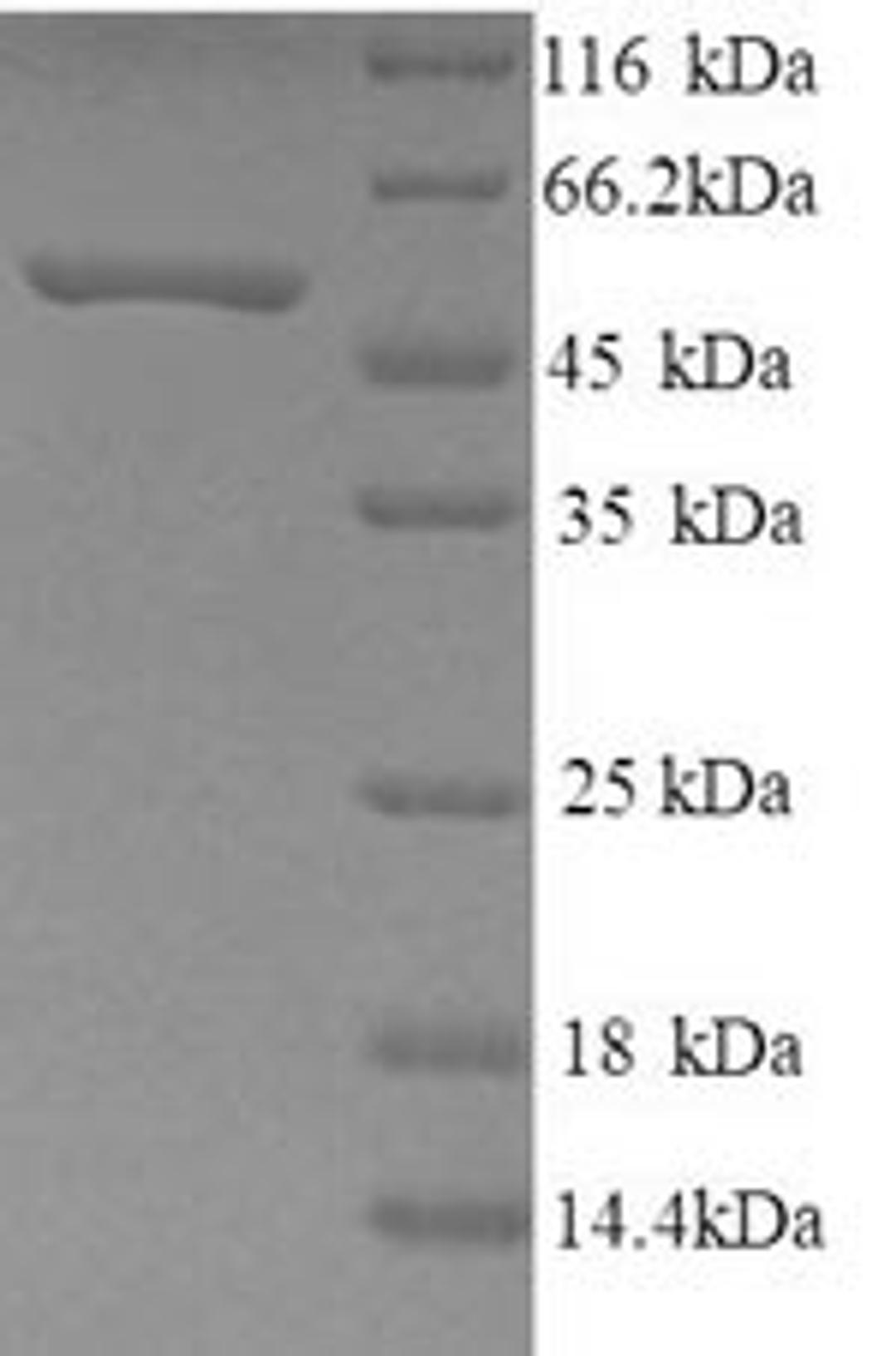 (Tris-Glycine gel) Discontinuous SDS-PAGE (reduced) with 5% enrichment gel and 15% separation gel.