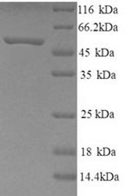 (Tris-Glycine gel) Discontinuous SDS-PAGE (reduced) with 5% enrichment gel and 15% separation gel.
