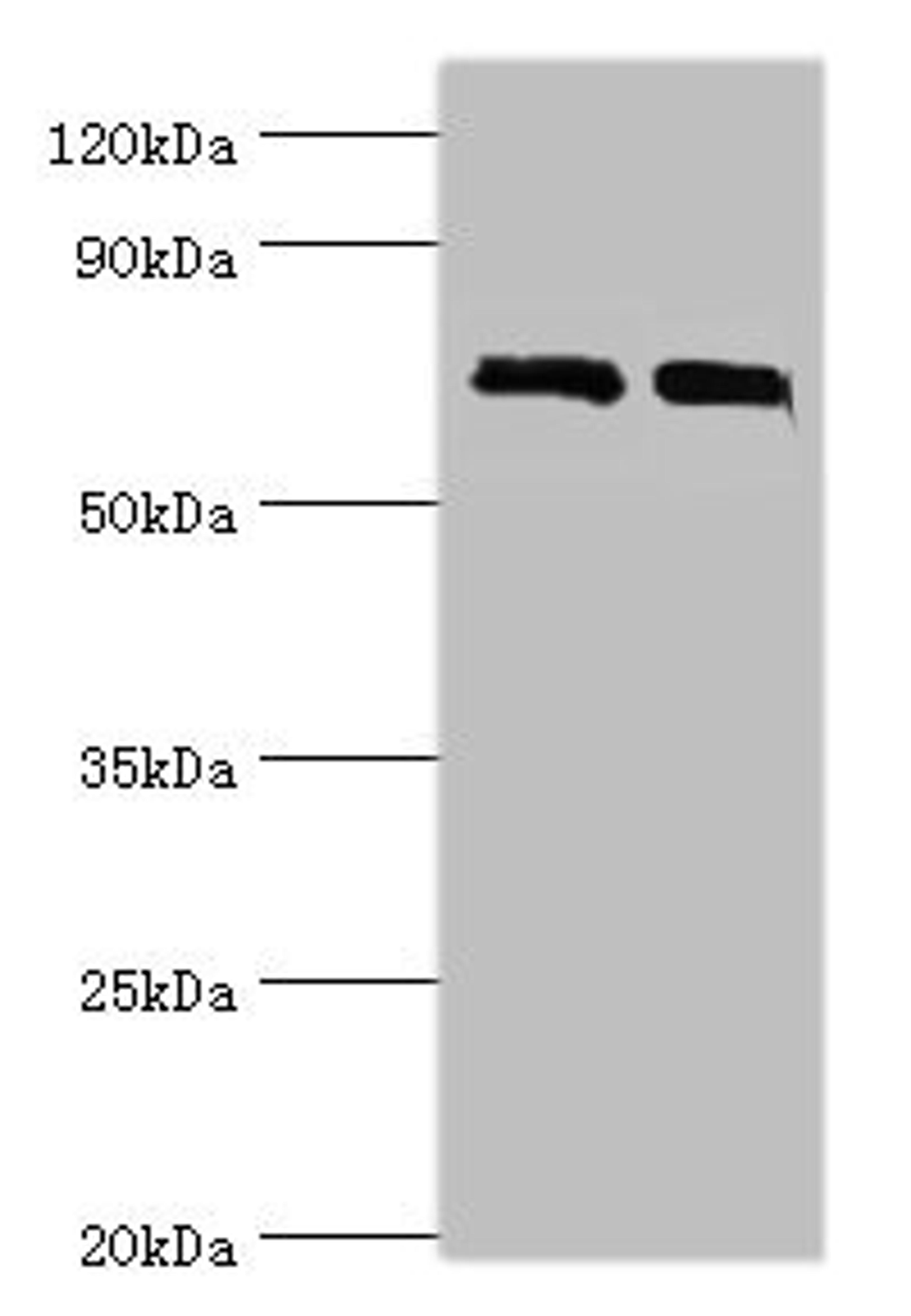Western blot. All lanes: DHX58 antibody at 12ug/ml. Lane 1: 293T whole cell lysate. Lane 2: Rat kidney tissue. Secondary. Goat polyclonal to rabbit IgG at 1/10000 dilution. Predicted band size: 77 kDa. Observed band size: 77 kDa. 