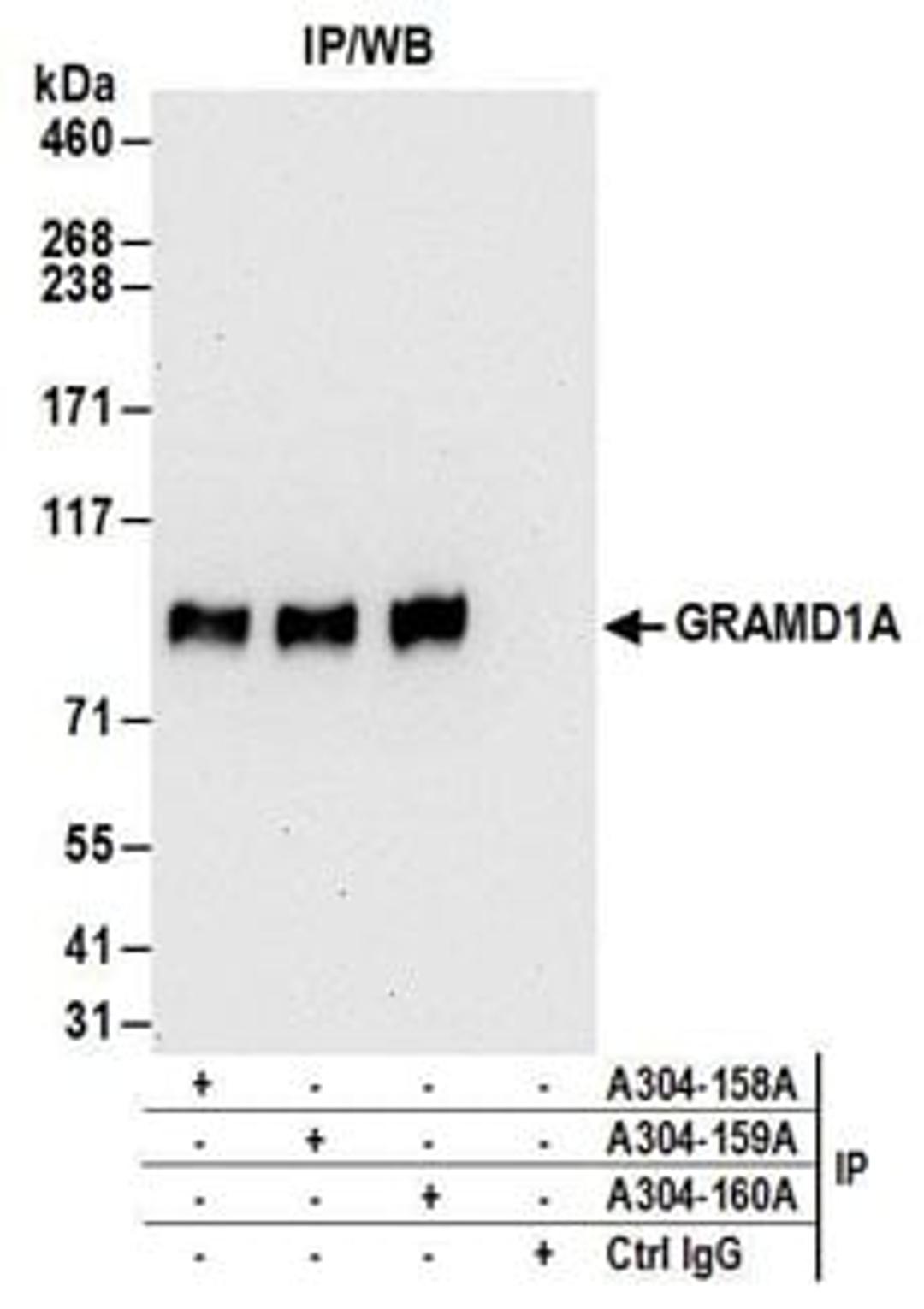 Detection of human GRAMD1A by western blot of immunoprecipitates.