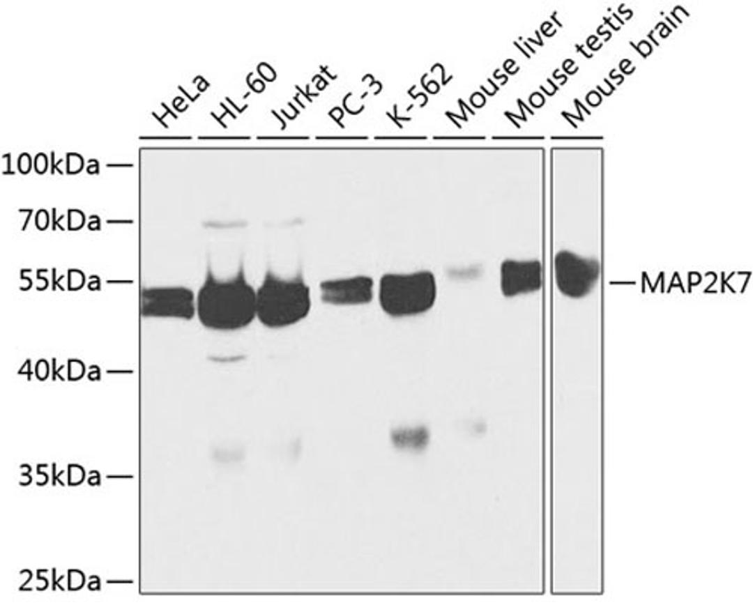 Western blot - MAP2K7 antibody (A2186)