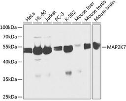 Western blot - MAP2K7 antibody (A2186)