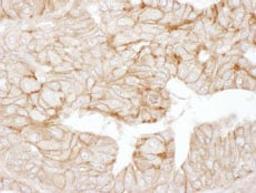 Detection of human Alpha-Adducin by immunohistochemistry.