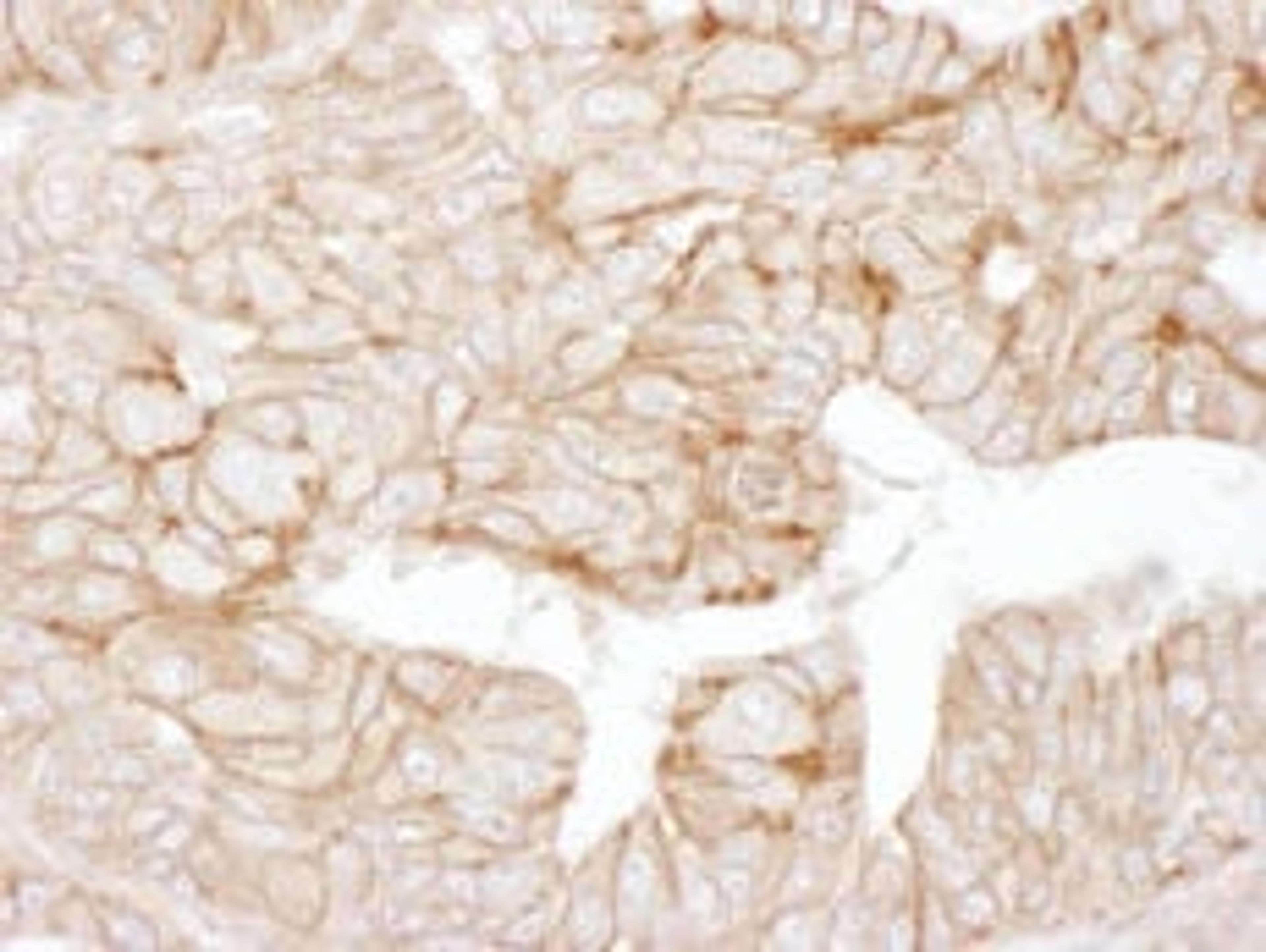 Detection of human Alpha-Adducin by immunohistochemistry.