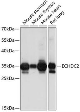 Western blot - ECHDC2 antibody (A14591)