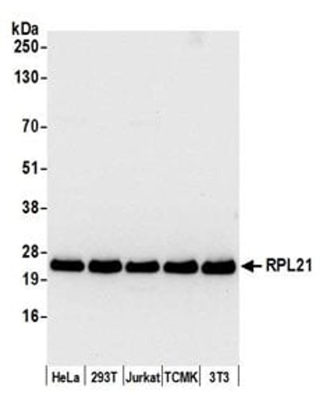 Detection of human and mouse RPL21 by western blot.