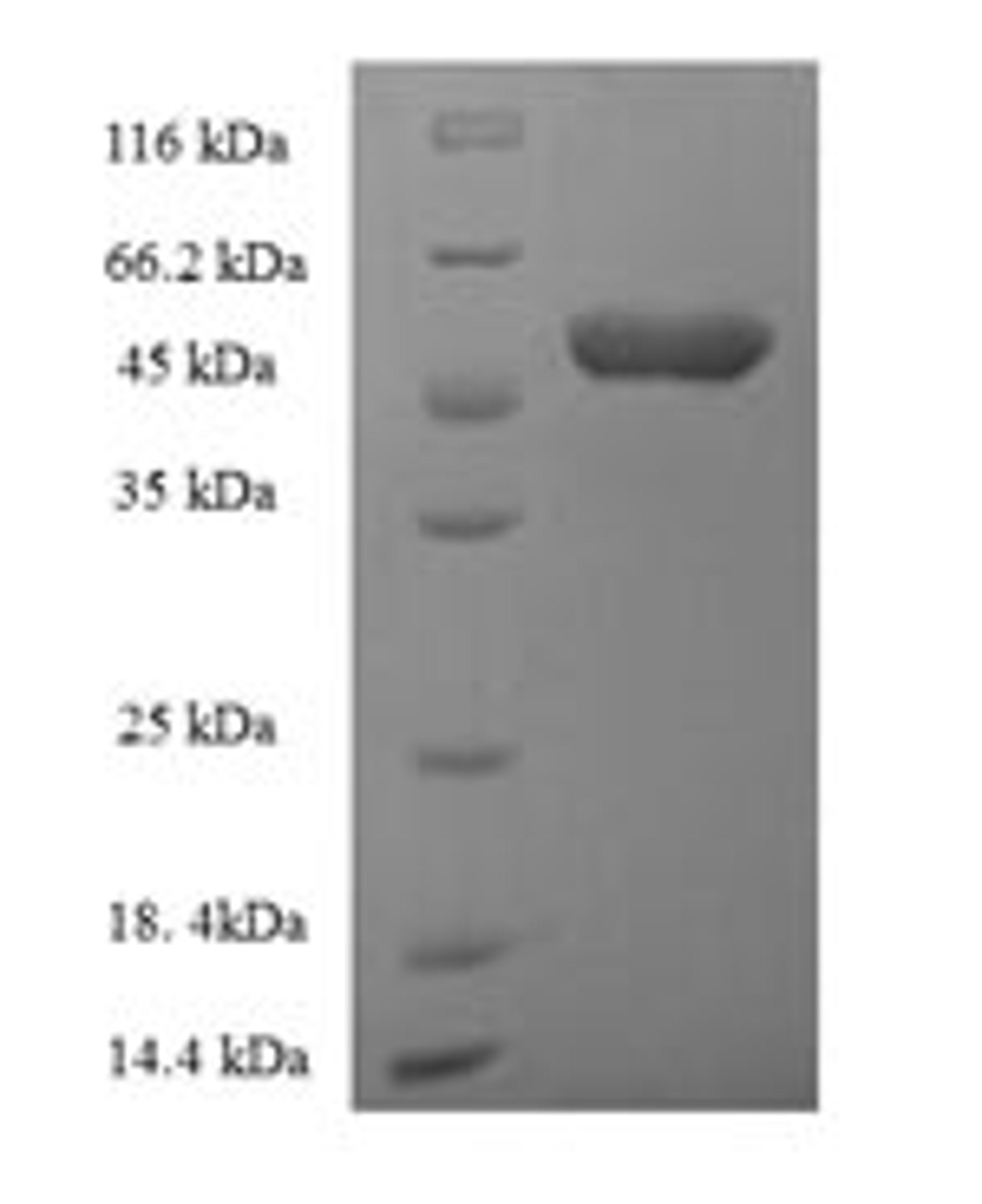 (Tris-Glycine gel) Discontinuous SDS-PAGE (reduced) with 5% enrichment gel and 15% separation gel.