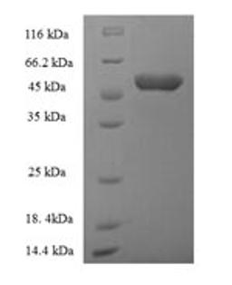 (Tris-Glycine gel) Discontinuous SDS-PAGE (reduced) with 5% enrichment gel and 15% separation gel.