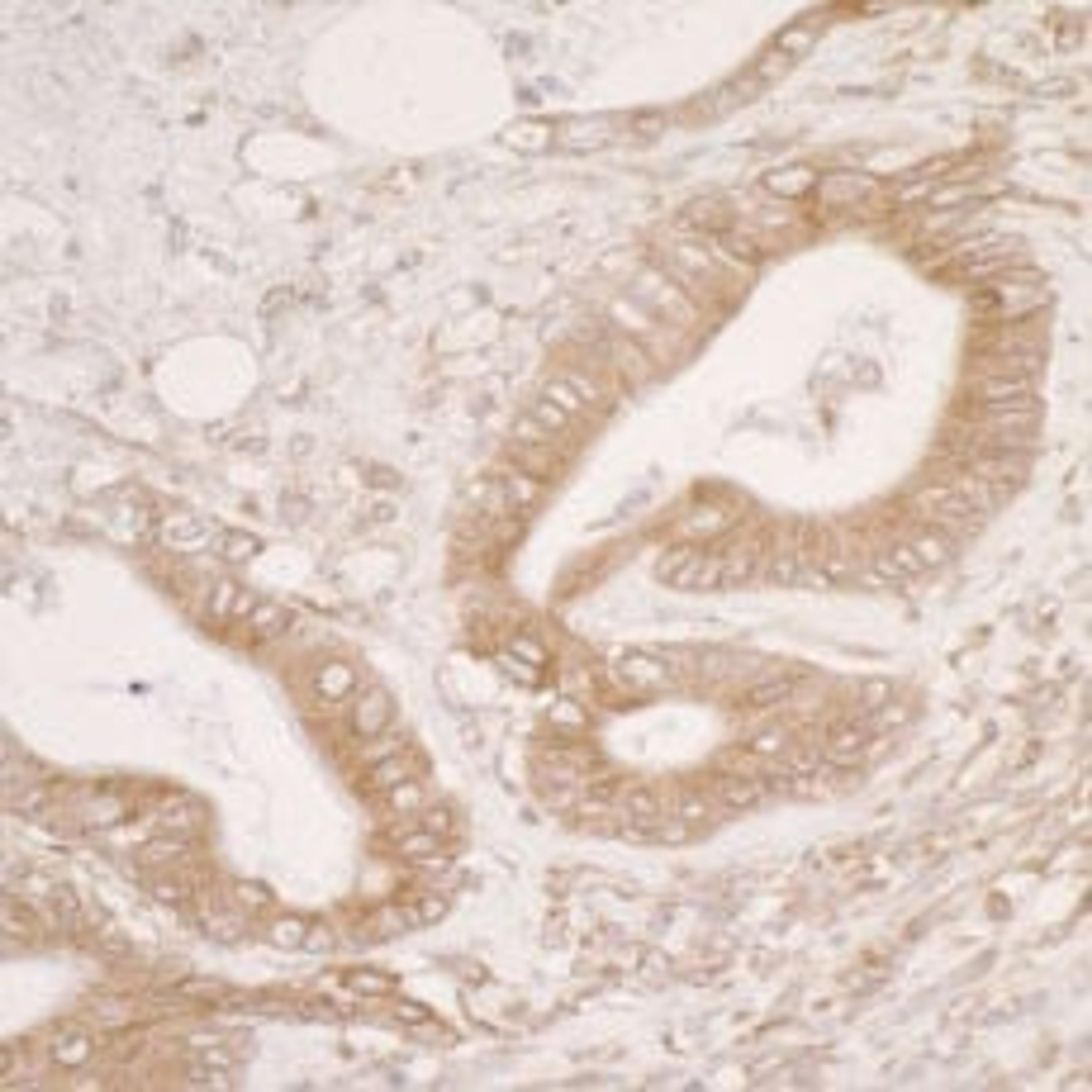 Detection of human PDIA3 by immunohistochemistry.