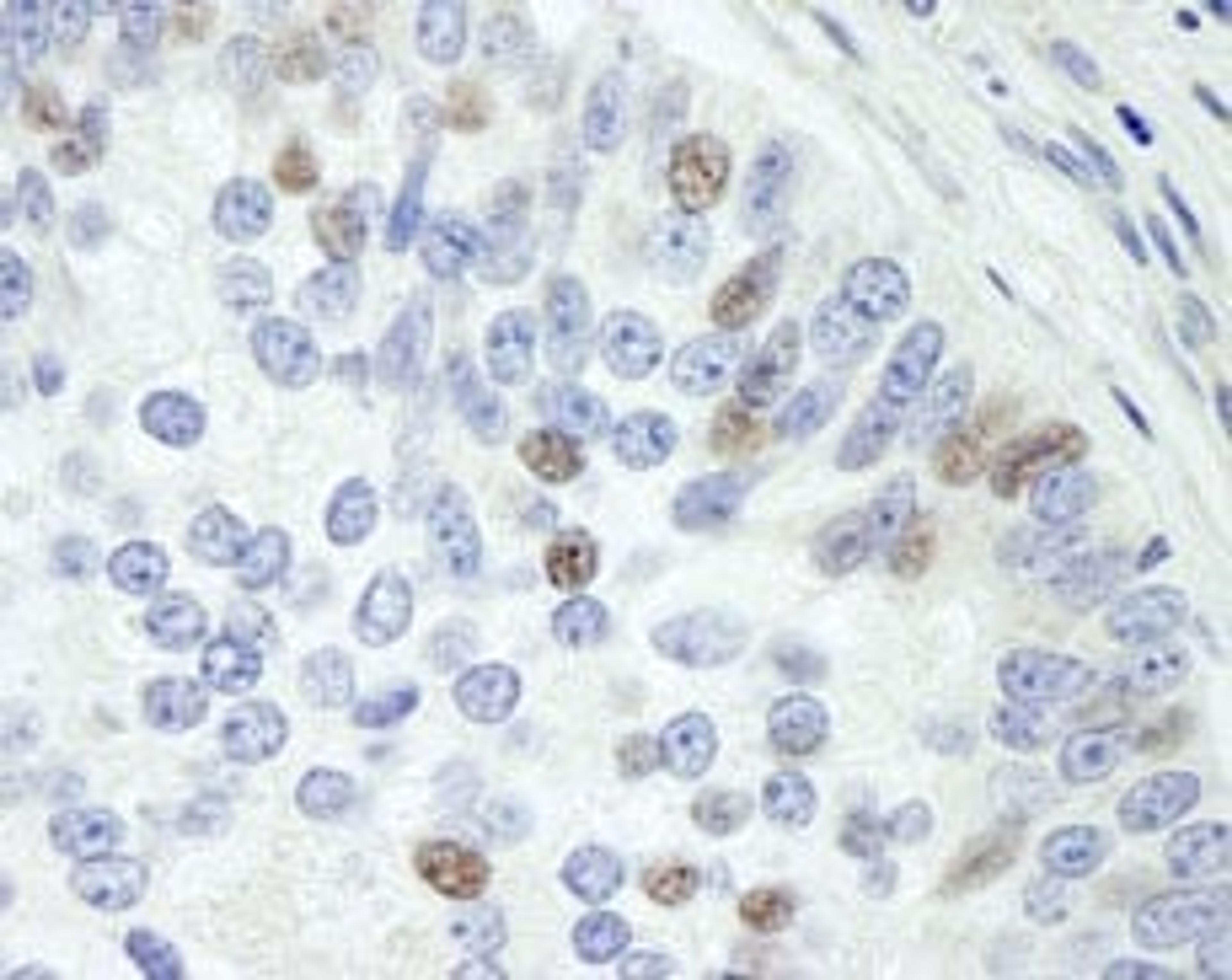 Detection of human Sin1 by immunohistochemistry.