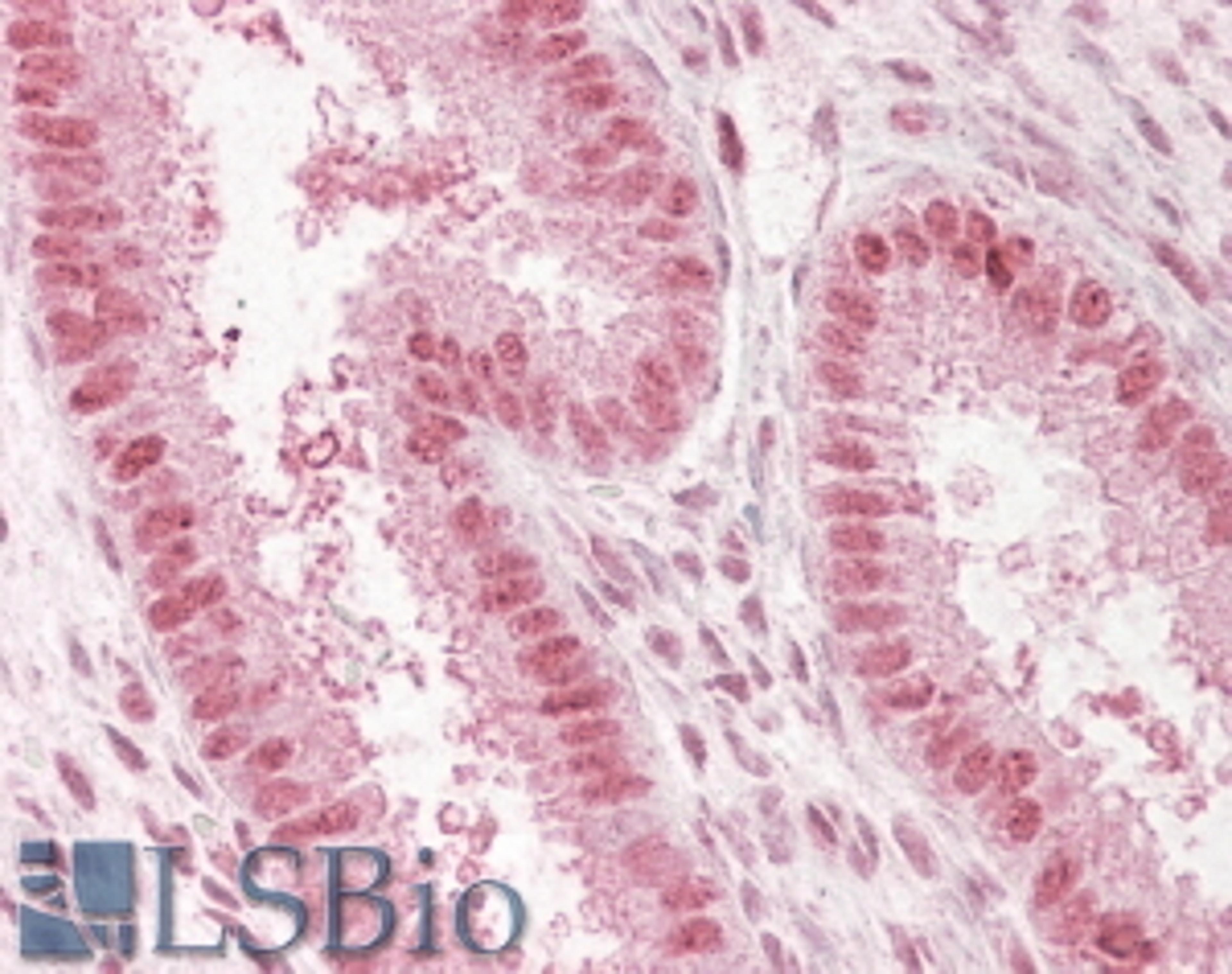 45-985 (3.8ug/ml) staining of paraffin embedded Human Uterus. Steamed antigen retrieval with citrate buffer pH 6, AP-staining.