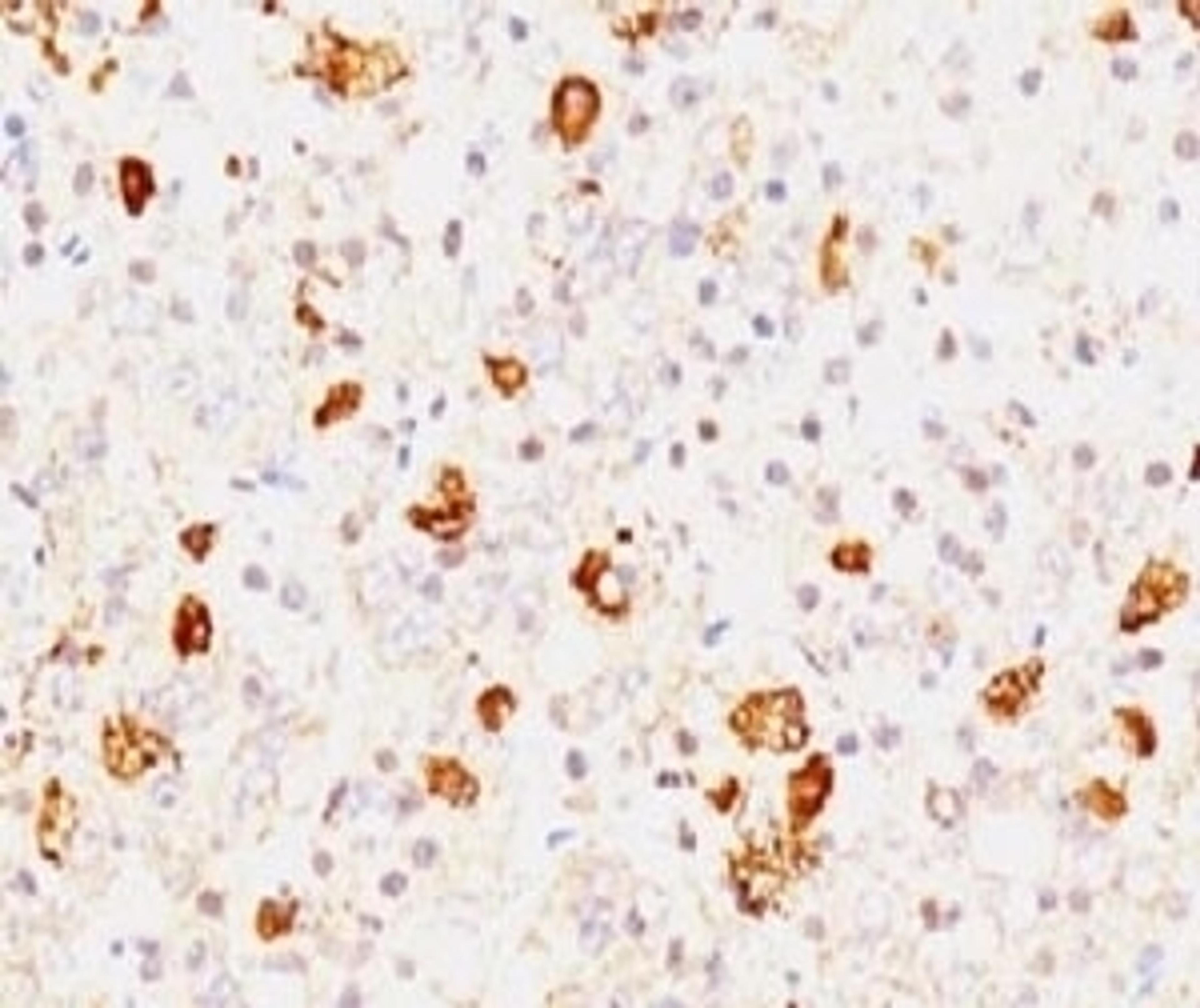 IHC testing of FFPE human pituitary and FSH-beta antibody (FLTPb-1 ).