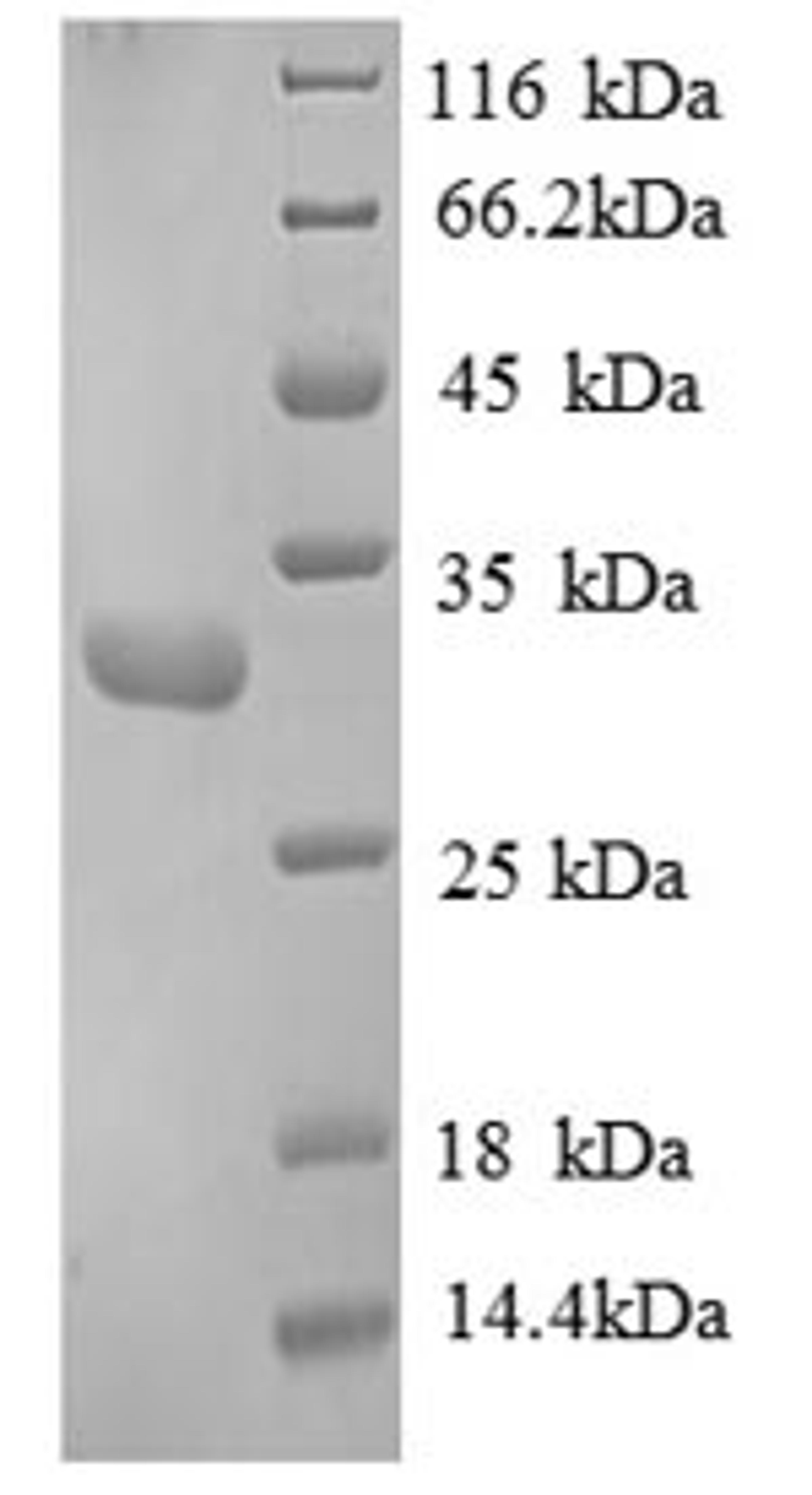 (Tris-Glycine gel) Discontinuous SDS-PAGE (reduced) with 5% enrichment gel and 15% separation gel.