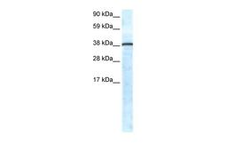 Antibody used in WB on Human Lung at 0.2-1 ug/ml.