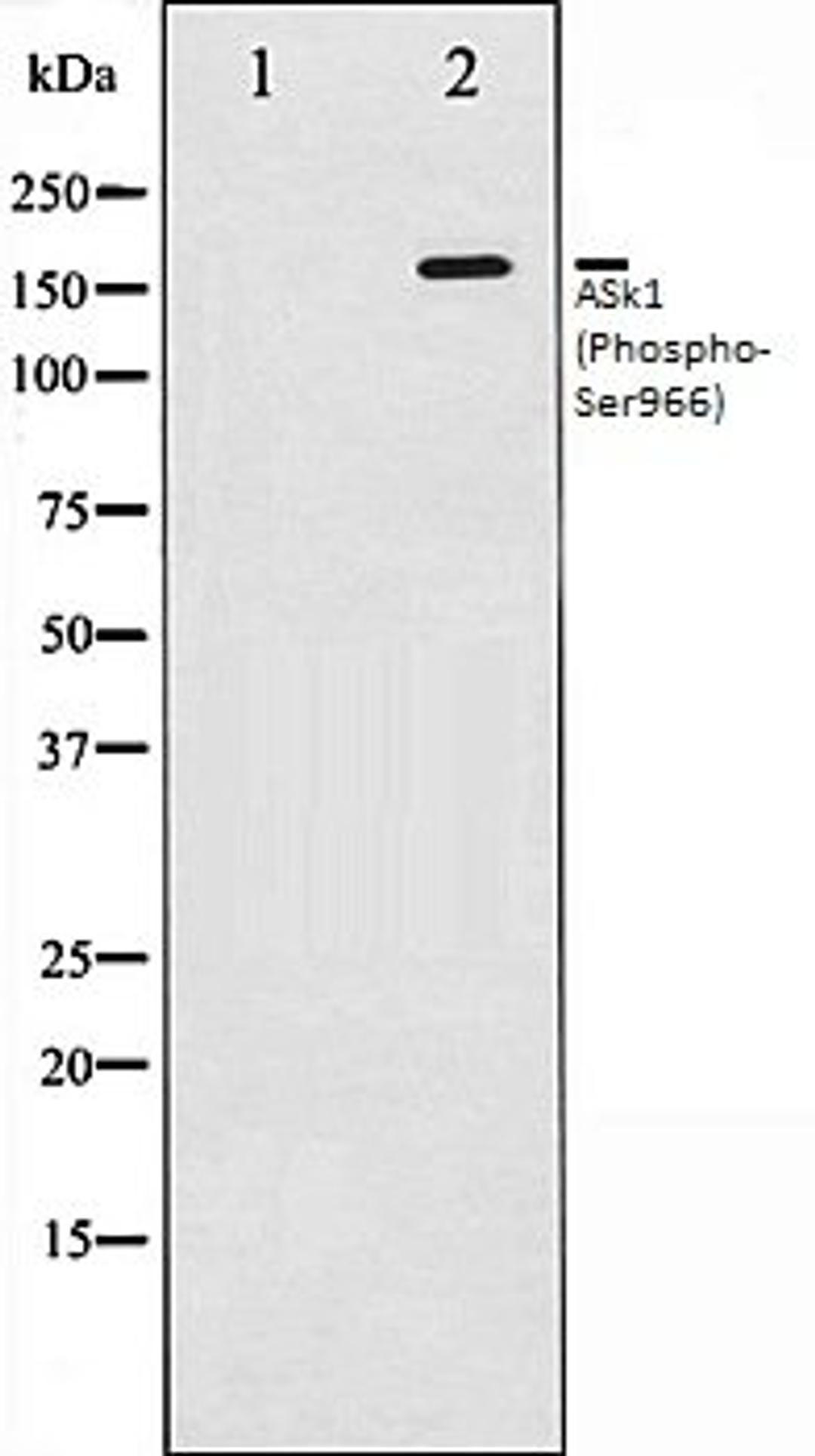 Western blot analysis of 293 whole cell lysates using ASK1 (Phospho-Ser966) antibody, The lane on the left is treated with the antigen-specific peptide.