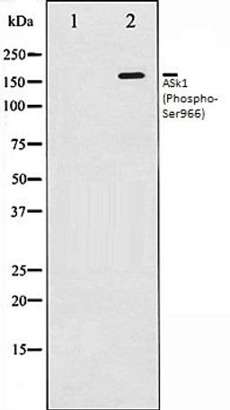 Western blot analysis of 293 whole cell lysates using ASK1 (Phospho-Ser966) antibody, The lane on the left is treated with the antigen-specific peptide.