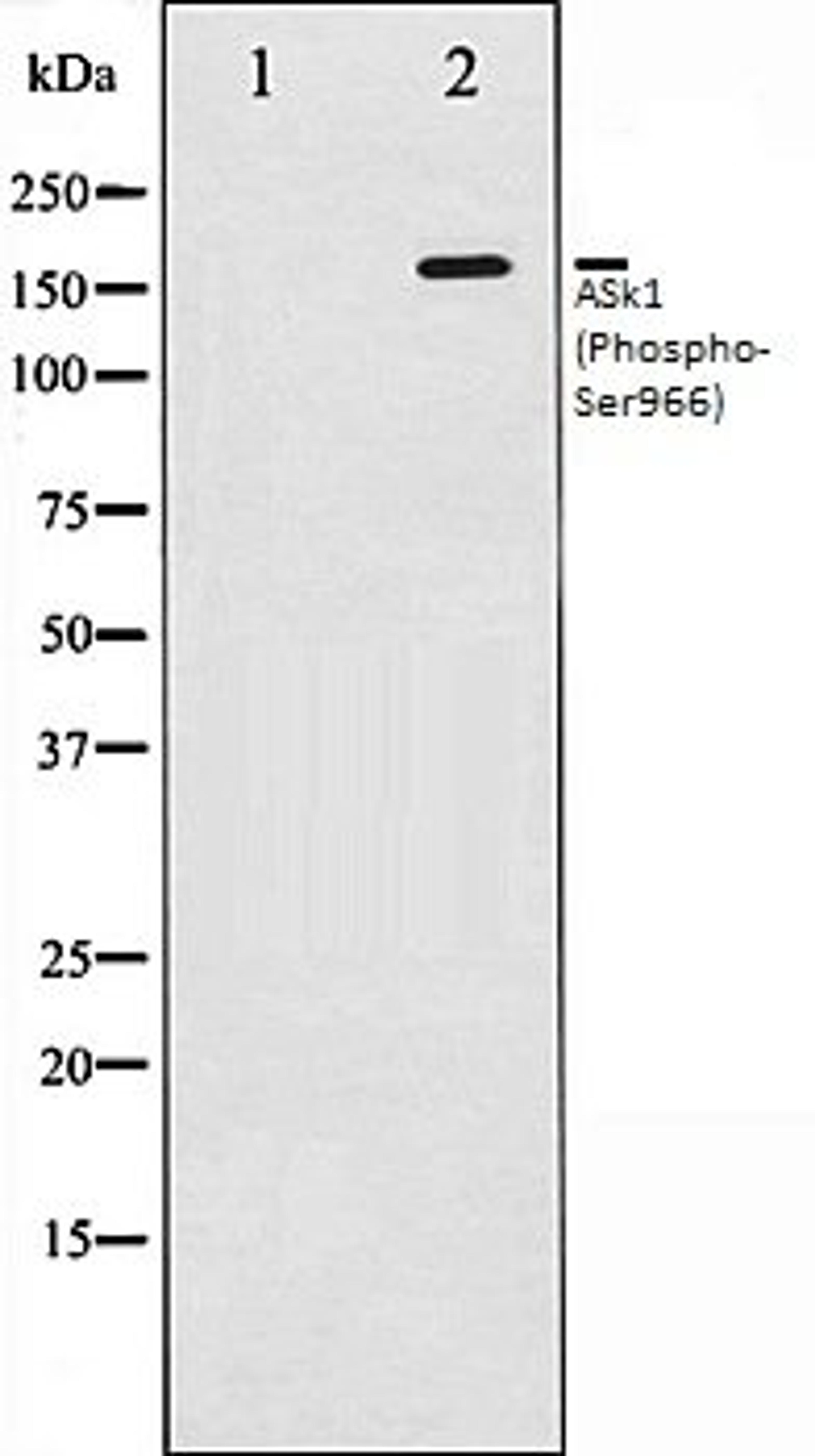 Western blot analysis of 293 whole cell lysates using ASK1 (Phospho-Ser966) antibody, The lane on the left is treated with the antigen-specific peptide.