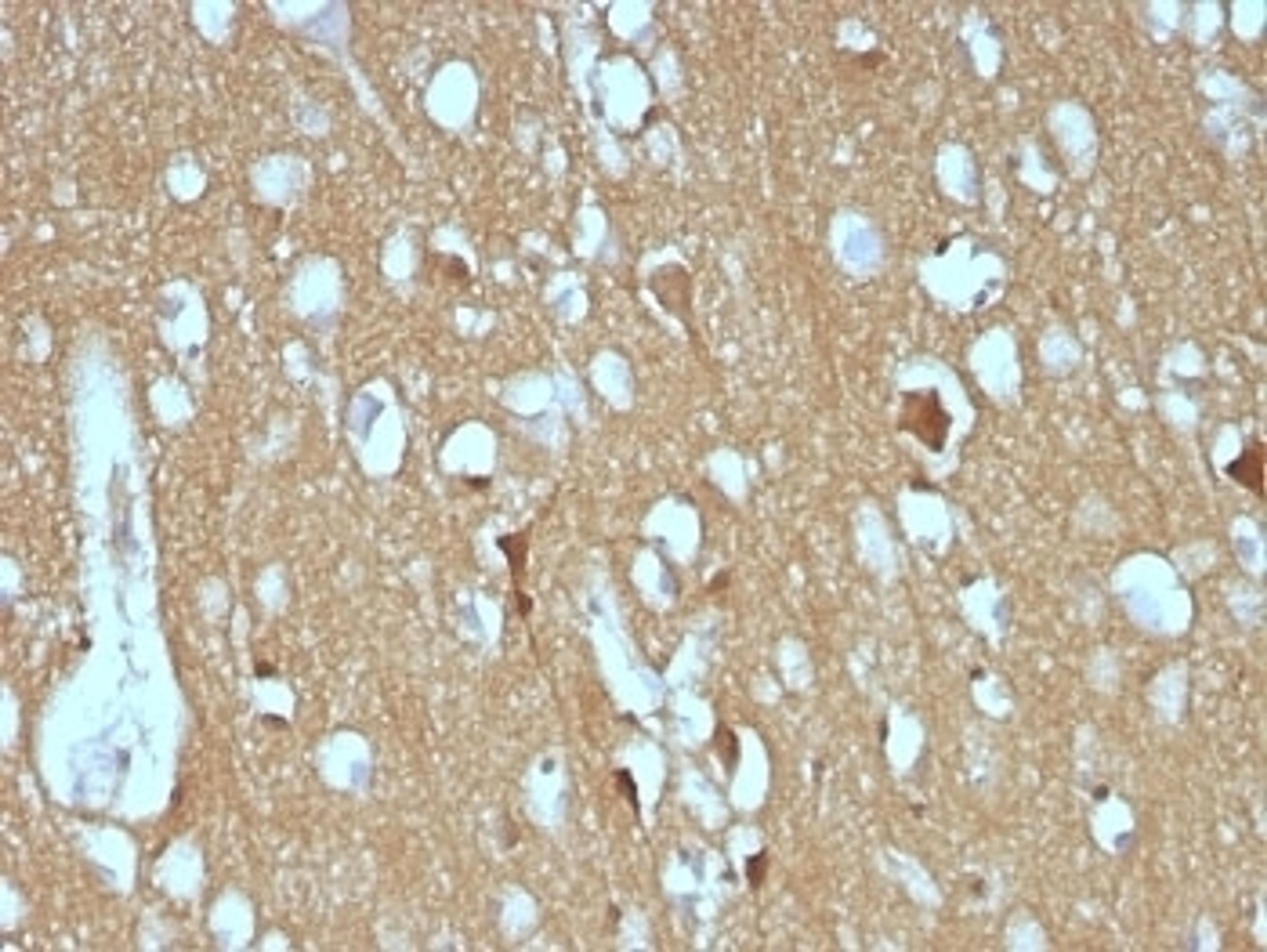 Formalin-fixed, paraffin-embedded human cerebellum stained with CD56 antibody (SPM128)