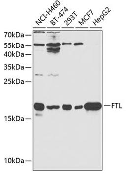 Western blot - FTL antibody (A1768)