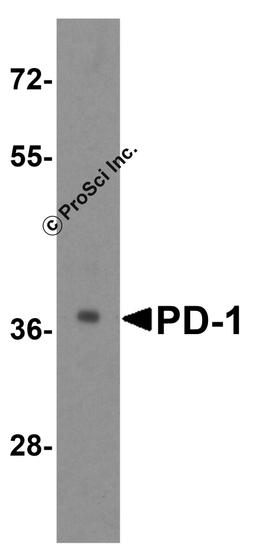 Western blot analysis of PD-1 in transfected 293 cell lysate with PD-1 antibody at 1 μg/mL.
