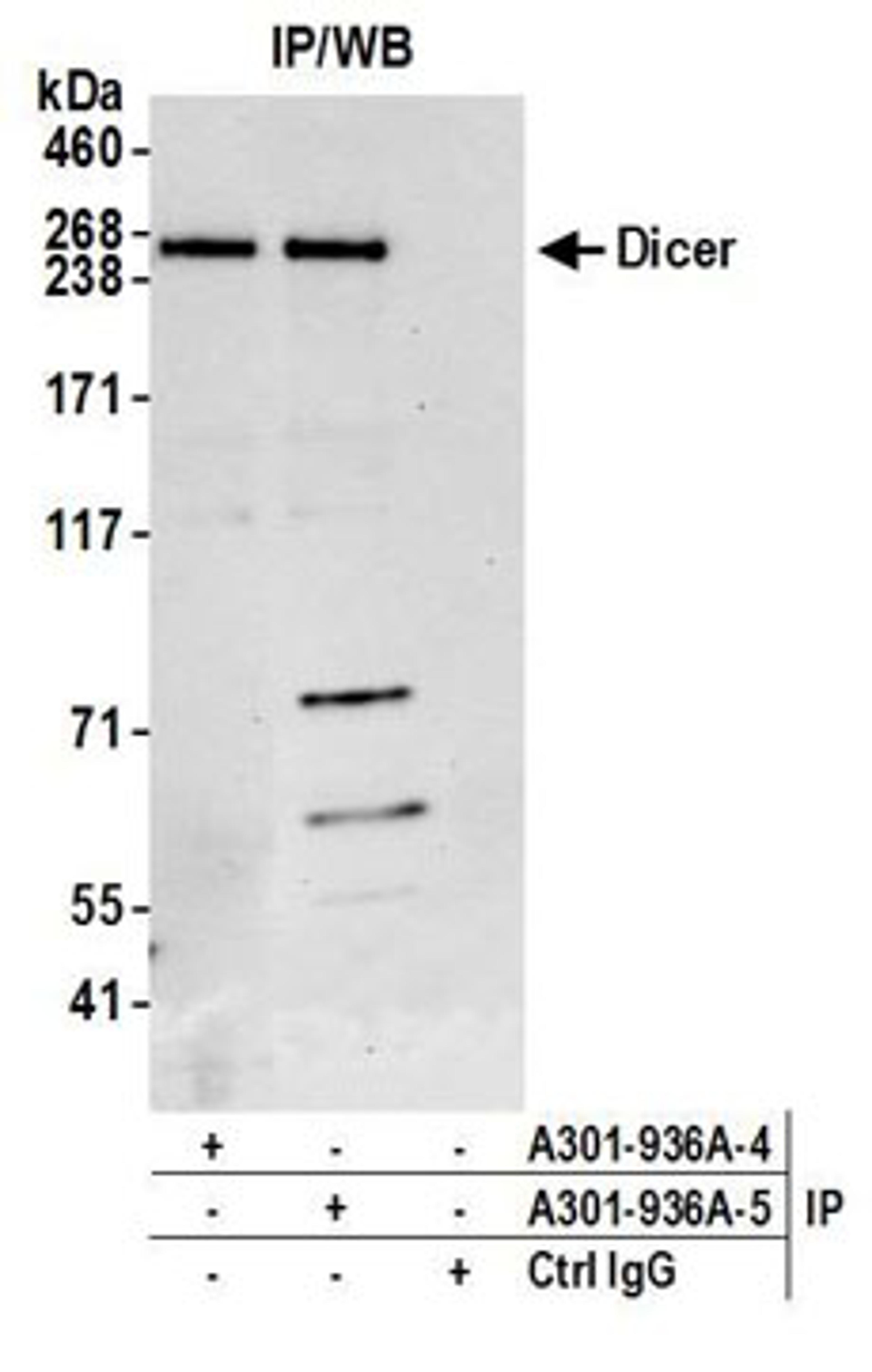 Detection of human Dicer by western blot of immunoprecipitates.